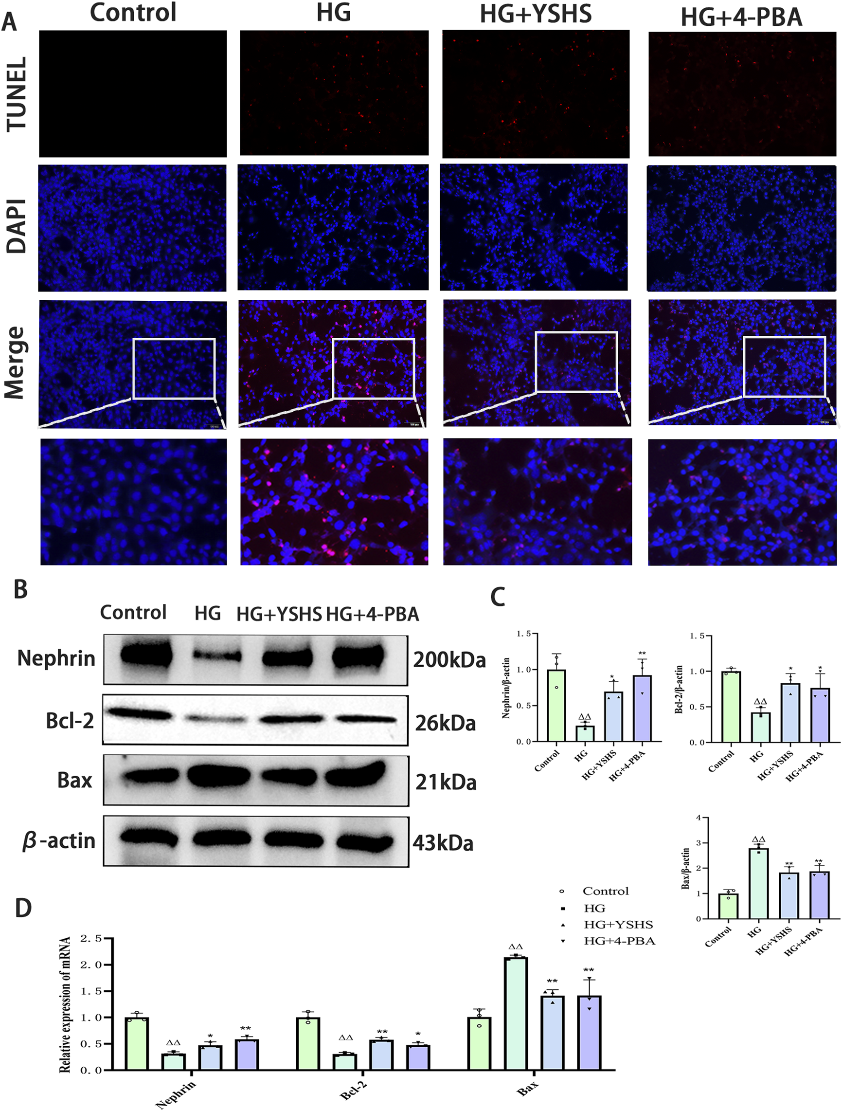Panel A shows fluorescence microscopy images with TUNEL and DAPI staining in four groups: Control, HG, HG+YSHS, and HG+4-PBA. Panel B contains Western blot images showing protein levels of Nephrin, Bcl-2, Bax, and β-actin in the same groups. Panel C presents histograms quantifying protein levels relative to β-actin. Panel D depicts bar graphs of relative mRNA expression for Nephrin, Bcl-2, and Bax. Statistical annotations indicate significance levels among groups.