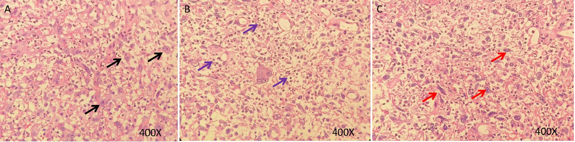 Histological images showing tissue samples labeled A, B, and C at four hundred times magnification. Each panel displays various cellular structures with arrows indicating specific features: black arrows in A, blue arrows in B, and red arrows in C.