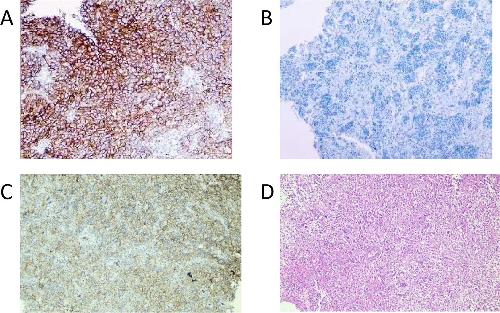 Histological images show sections labeled A, B, C, and D. Image A displays densely packed, brown-stained cells. Image B shows blue-stained cells with a lighter background. Image C consists of pale brown-stained cellular structures. Image D features a dense collection of pink and purple cells. Each section exhibits different staining patterns, indicative of diverse tissue characteristics.