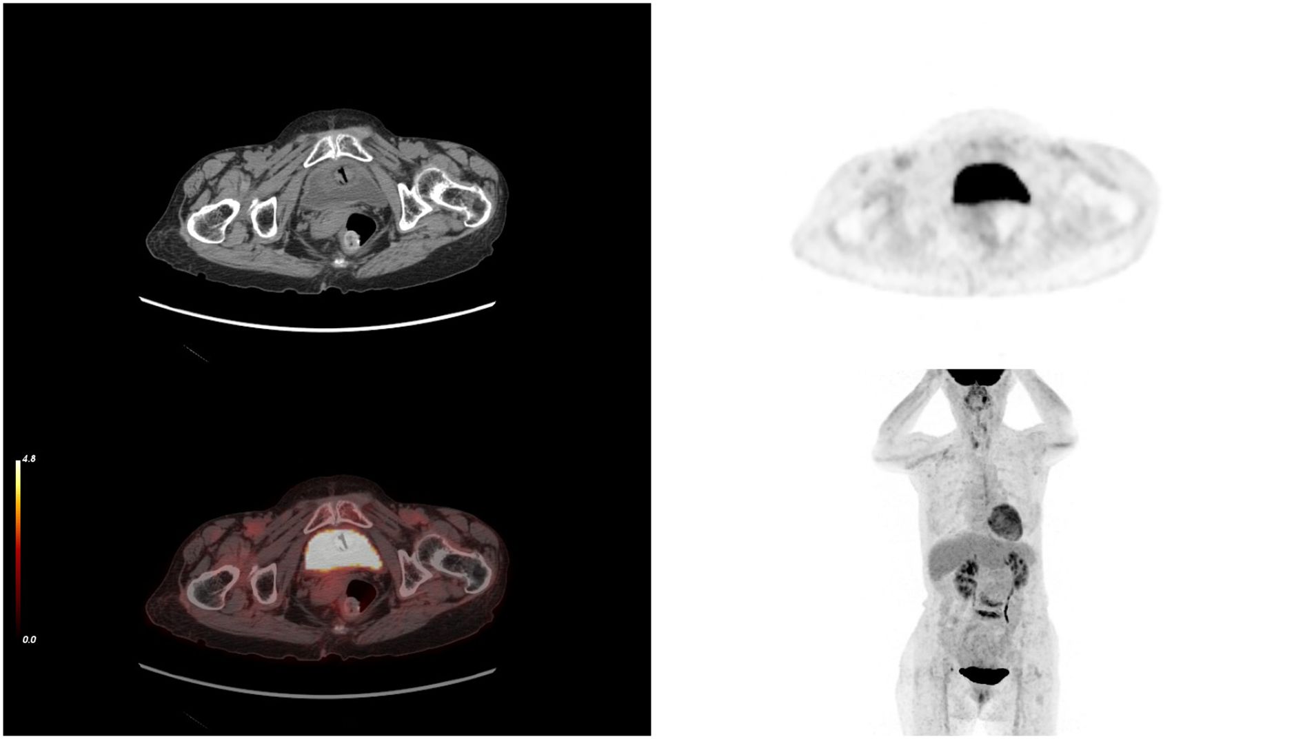 Four MRI scans and one PET scan display cross-sectional images of the human body, highlighting various internal structures. Two MRIs are marked with arrows indicating specific areas. The PET scan shows an outlined human form with prominent dark regions.