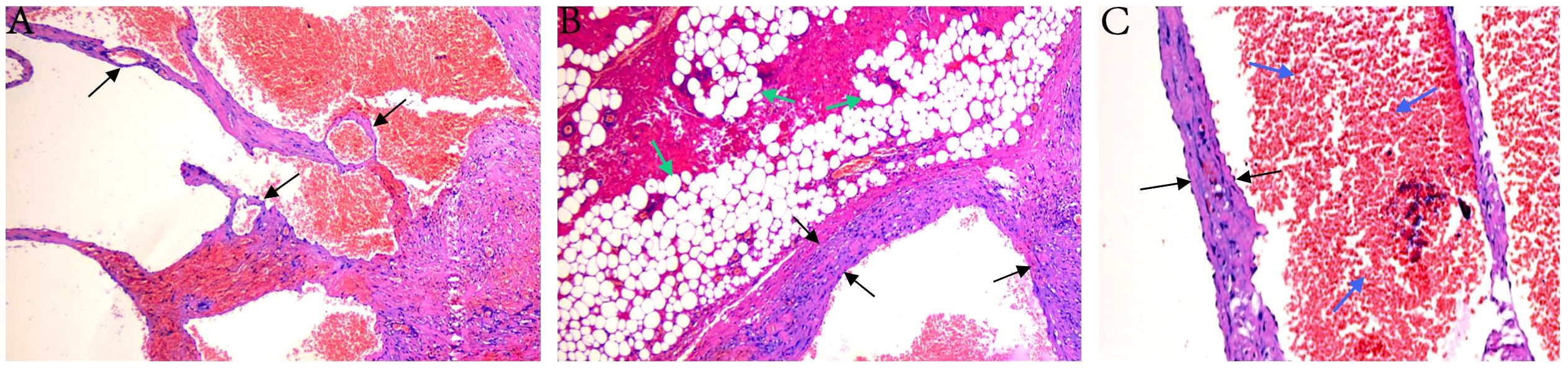 Histological images showing three panels labeled A, B, and C. Panel A displays tissue structures with purple, red, and white areas, and arrows highlighting specific regions. Panel B shows a dense collection of white, circular cells with arrows indicating key areas. Panel C contains elongated, red cellular structures with arrows pointing to certain features.