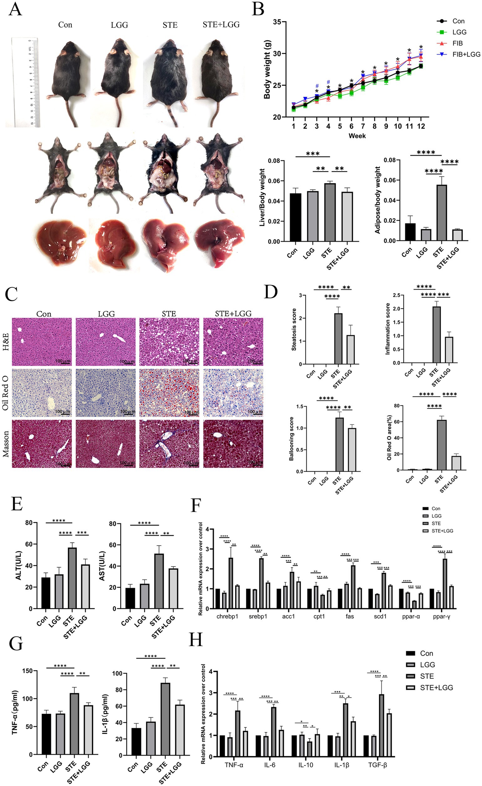 Laboratory images and graphs comparing the effects of different treatments (Con, LGG, STE, STE+LGG) on mice. Panel A shows mice, dissected views, and liver images under different conditions. Panel B displays body weight and liver-weight graphs over time. Panel C presents histological images (H&E, Oil Red O, Masson) for each condition. Panel D contains bar graphs of scores for steatosis, inflammation, ballooning, and Oil Red O areas. Panels E-H include comparative bar graphs of enzyme levels, mRNA expression, and cytokine levels across conditions, indicating statistical significance with asterisks.