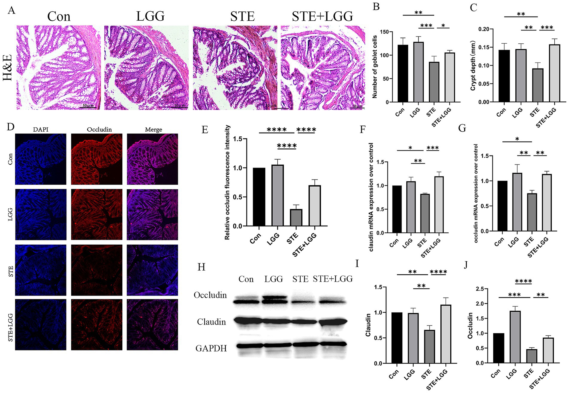 Histological and experimental data analysis in multiple panels labeled A to J. Panel A shows H&E stained tissue images under different treatments: Con, LGG, STE, and STE+LGG. Panels B and C display bar graphs for goblet cell numbers and crypt depth. Panel D includes DAPI, Occludin staining, and merge images for each treatment. Panel E shows a bar graph of occludin fluorescence intensity. Panels F and G present mRNA expression levels of claudin and occludin. Panel H shows Western blot results for Occludin, Claudin, and GAPDH. Panels I and J provide bar graphs of Claudin and Occludin levels. Statistical significance is indicated with asterisks.