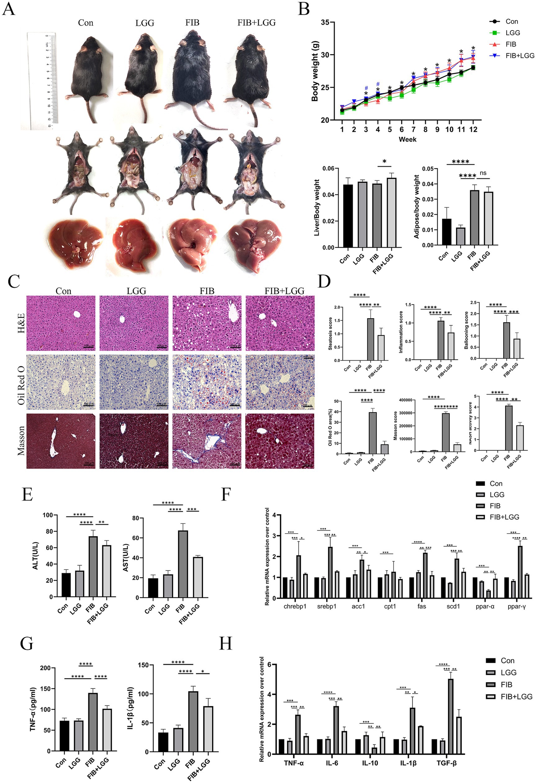 Research image showing effects of different treatments on mice, weight gain, and liver conditions. It includes: A) photos of mice and livers under various treatments; B) graphs of body weight and liver/body weight ratios; C) histological liver sections; D-H) bar graphs displaying statistical analyses of liver health markers and gene expressions. Graphs include data on enzymes and inflammatory markers with significant differences indicated.