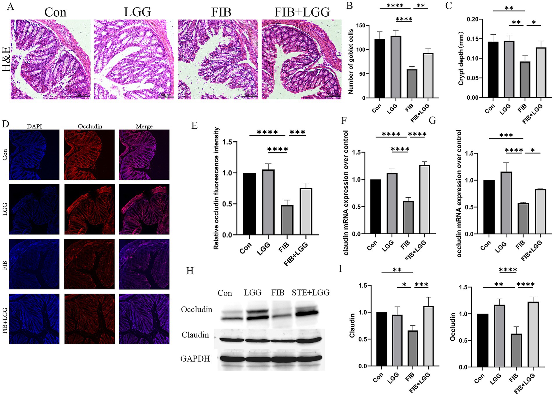 Histological comparison of treatments: Panel A shows H&E stained tissue sections for control, LGG, FIB, and FIB+LGG groups. Panel B and C display bar graphs of goblet cell numbers and crypt depth. Panel D illustrates immunofluorescence images for occludin expression. Panels E, F, and G show bar graphs for occludin fluorescence, and claudin and occludin mRNA expressions. Panel H provides Western blot results for occludin, claudin, and GAPDH. Panel I presents bar graphs comparing claudin and occludin expressions across treatments. Statistical significance is indicated.