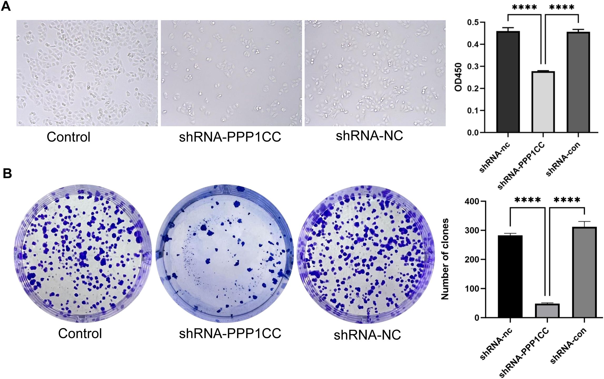 Panel A shows cell cultures with three conditions: Control, shRNA-PPP1CC, and shRNA-NC, with corresponding microscopy images. A bar graph indicates a decrease in OD450 for shRNA-PPP1CC compared to others, with statistical significance marked by asterisks. Panel B displays colony formation assays under the same conditions. The corresponding bar graph shows a significant reduction in the number of clones for shRNA-PPP1CC, with asterisks indicating significance.