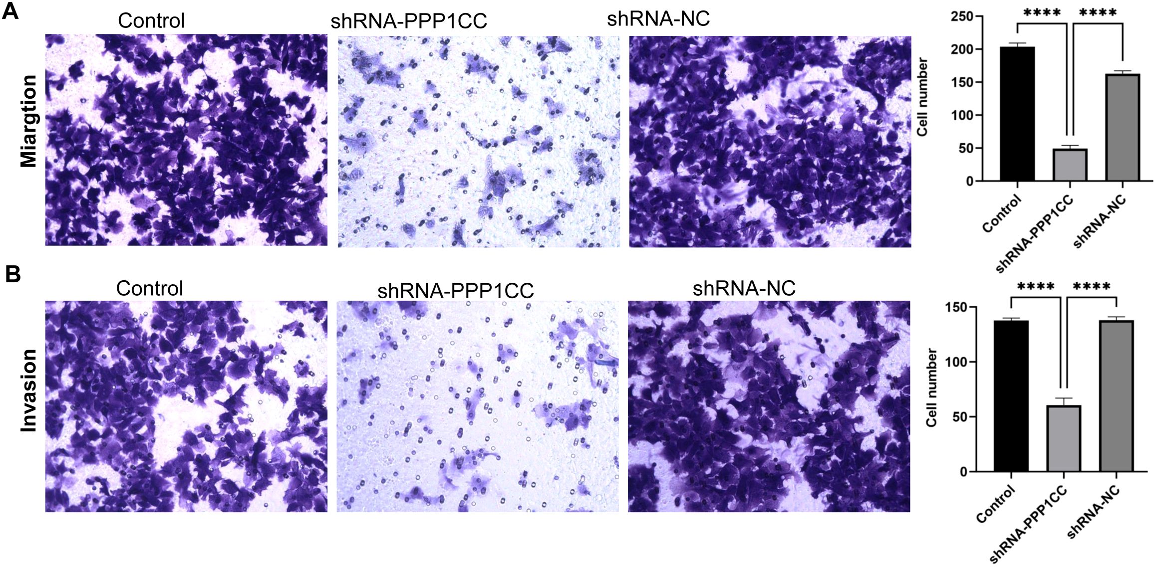 Images show cell migration and invasion assays. Panel A displays three conditions for cell migration: Control, shRNA-PPP1CC, and shRNA-NC, with a bar graph showing reduced cell numbers in shRNA-PPP1CC. Panel B illustrates cell invasion for the same conditions, with a similar graph indicating lower cell numbers for shRNA-PPP1CC. Both assays demonstrate significant differences.