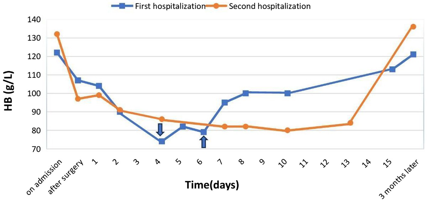 Line graph showing hemoglobin levels (g/L) over time during the first and second hospitalizations. The x-axis represents time in days, from admission to three months later. The blue line (first hospitalization) starts around 130, dips to 80, then rises sharply towards the end. The orange line (second hospitalization) begins slightly above 130, declines steadily to around 80, and rises slightly at the end.