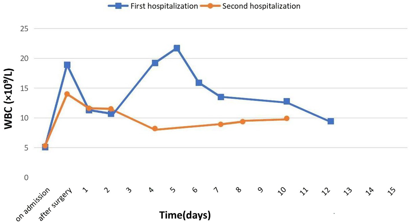 Line graph comparing white blood cell (WBC) counts over time for first and second hospitalizations. The blue line (first hospitalization) starts high, peaks, and then decreases. The orange line (second hospitalization) remains lower and stable. Time is measured in days along the x-axis.