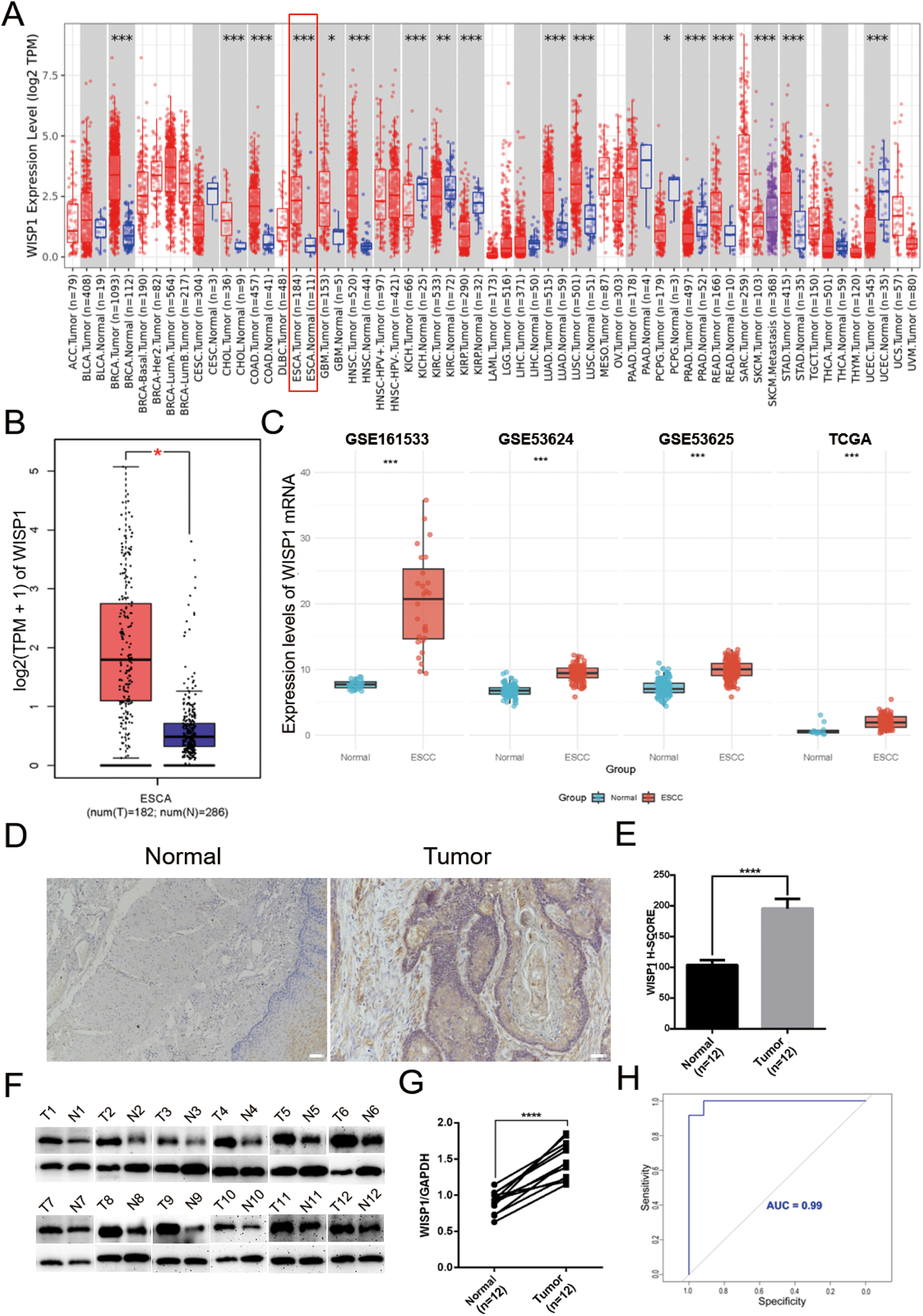 A series of scientific diagrams and charts analyzing WISP1 expression in various contexts. Panel A shows a box plot of WISP1 expression levels across different tumor types and normal tissues. Panel B highlights expression differences between normal and esophageal squamous cell carcinoma (ESCC) tissues. Panel C presents box plots of WISP1 mRNA levels in different datasets, comparing normal and ESCC groups. Panel D shows immunohistochemistry images of normal and tumor tissues. Panel E is a bar graph comparing WISP1 scores in normal and tumor samples. Panel F shows Western blot images for WISP1 and GAPDH. Panel G graphs WISP1/GAPDH ratios. Panel H displays a receiver operating characteristic curve with an AUC of 0.99.