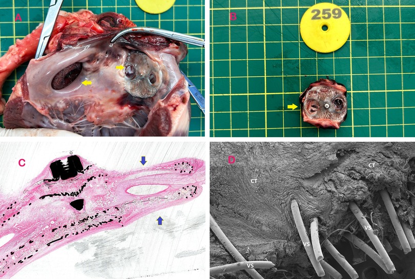 Panels of an anatomical and histological study. Panel A shows a dissected view of tissue with exposed structures on a grid surface. Panel B displays a cross-section of the tissue with a yellow label marked \