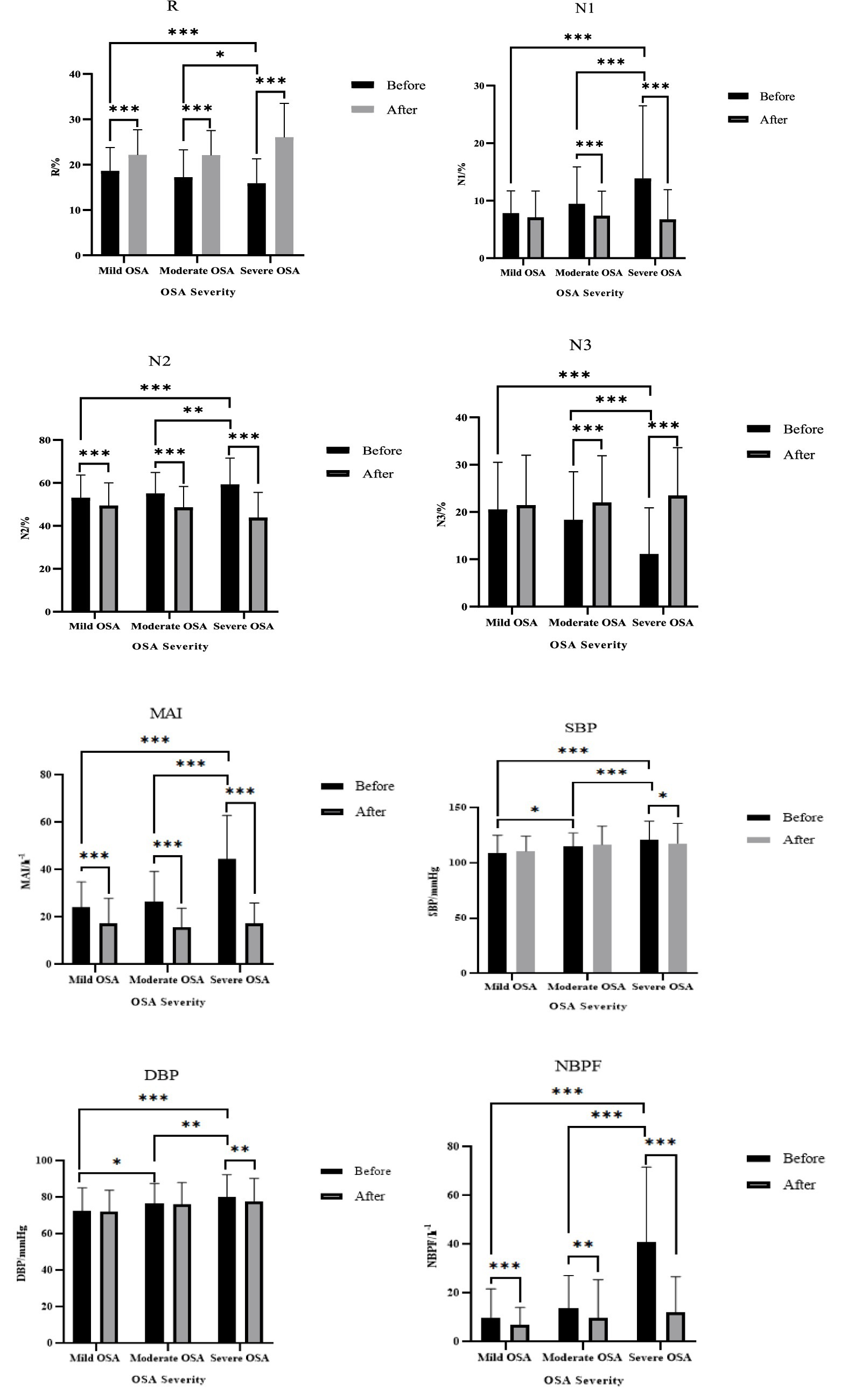 Bar charts display changes before and after treatment across different OSA severity levels (mild, moderate, severe). Measurements include R%, N1%, N2%, N3%, MAI events per hour, SBP in millimeters of mercury, DBP in millimeters of mercury, and NBPF events per hour. Significant differences are marked with asterisks.