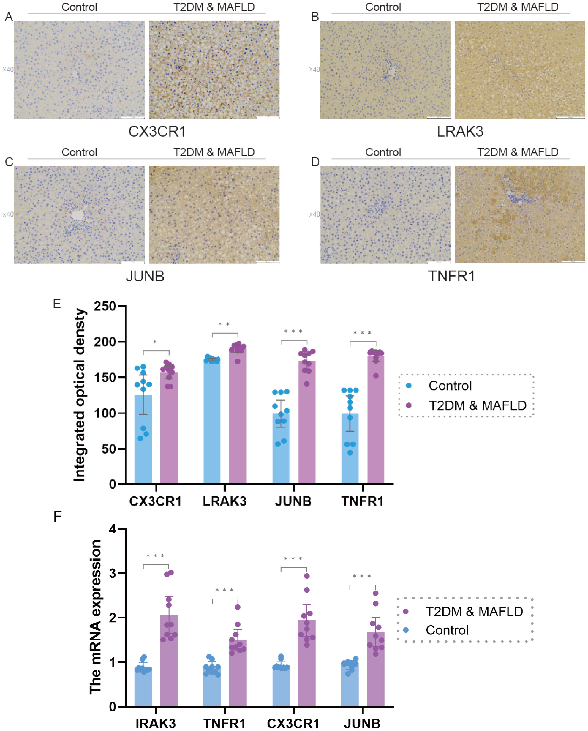 Histological and graphical analysis of biomarkers in liver conditions. Panels A-D show histology images comparing control and T2DM & MAFLD groups at 40x magnification, focusing on CX3CR1, LRAK3, JUNB, and TNFR1. Panels E and F display bar graphs indicating integrated optical density and mRNA expression levels for these biomarkers, with statistical significance noted. Comparison shows higher levels in T2DM & MAFLD than controls.