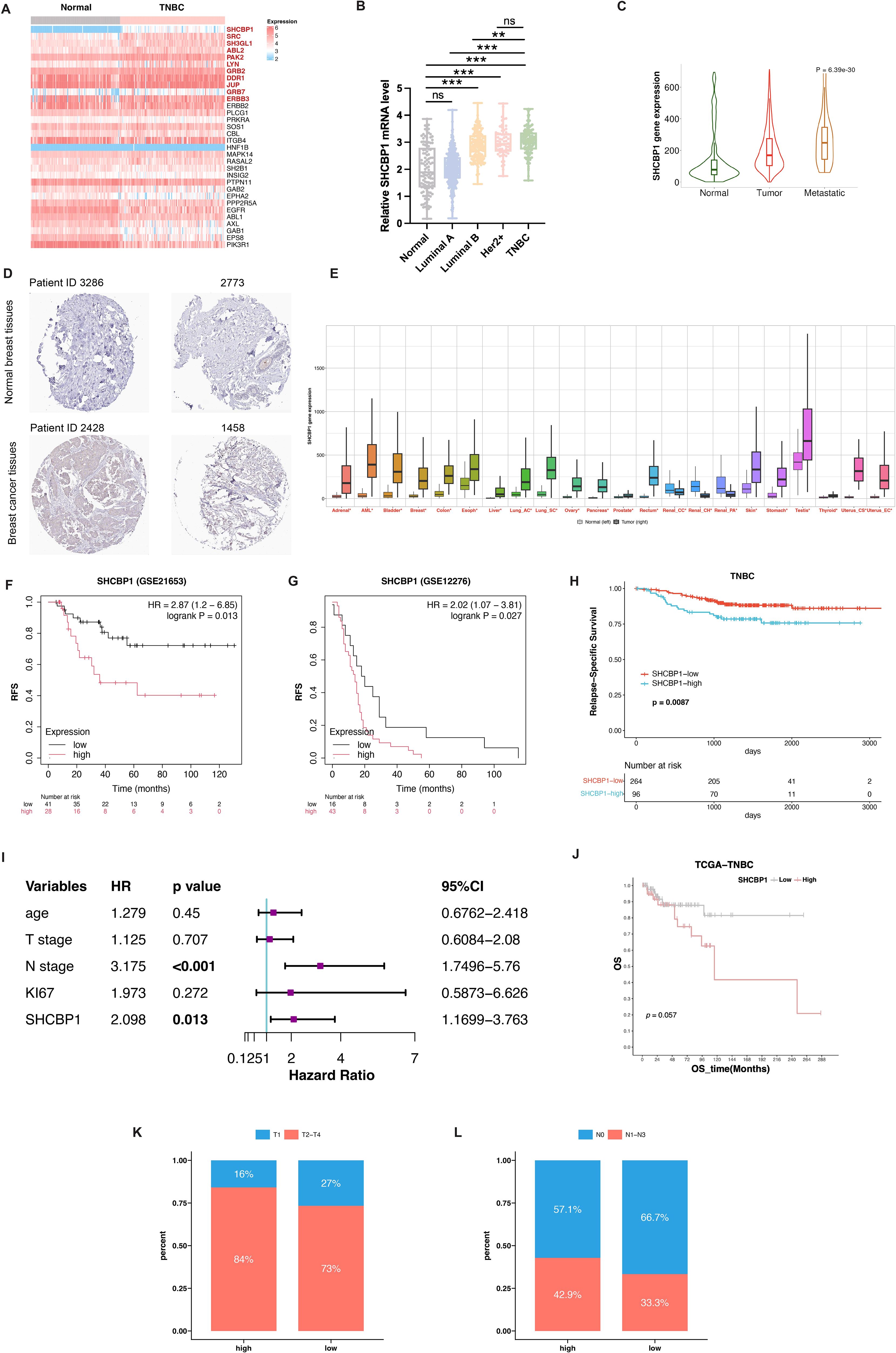 The image consists of multiple panels related to SHCBP1 expression in breast cancer research. Panel A shows a heatmap of gene expression comparing normal and TNBC tissues. Panel B displays a box plot of relative SHCBP1 mRNA levels across different breast cancer subtypes. Panel C features a violin plot of SHCBP1 gene expression in normal, tumor, and metastatic tissues. Panel D presents histological images of normal breast and cancer tissues. Panel E is a box plot of SHCBP1 expression across various breast cancer datasets. Panels F, G, and H show survival curves for patient groups with low and high SHCBP1 expression. Panel I is a forest plot of hazard ratios for clinical variables in breast cancer. Panels J, K, and L display various bar charts related to SHCBP1 expression and clinical outcomes.