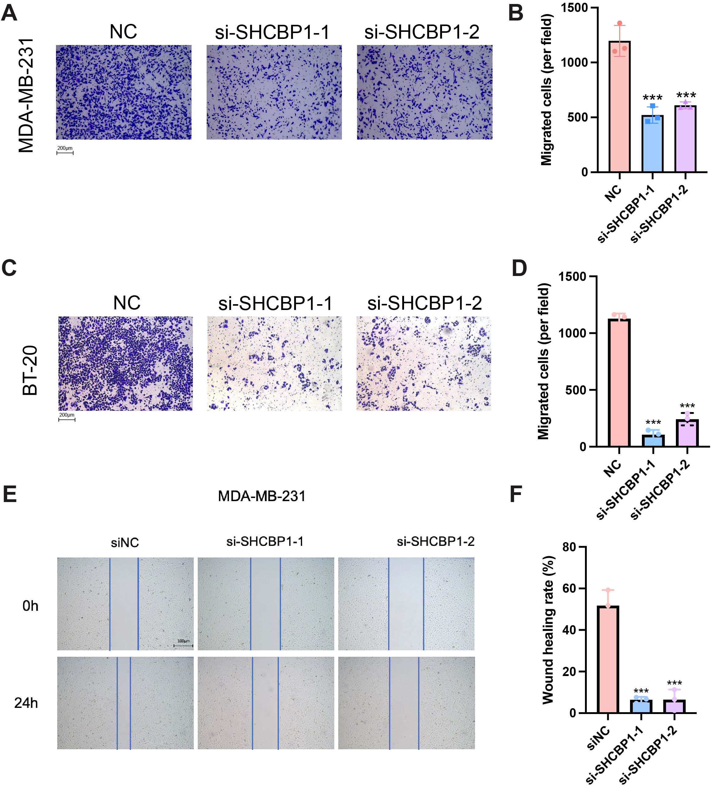 Panels depict cell migration and wound healing assays. Panels A and C show colored micrographs of migrated cells (stained) under different treatments for MDA-MB-231 and BT-20 cell lines. Bar charts B and D show reductions in migrated cells for si-SHCBP1-1 and si-SHCBP1-2 treatments compared to the control (NC). Panel E presents wound healing at 0 hours and 24 hours for MDA-MB-231 cells, with visible gaps. Chart F quantifies wound healing rates, showing reduced healing for si-SHCBP1 treatments. Scale bars are included in the images.