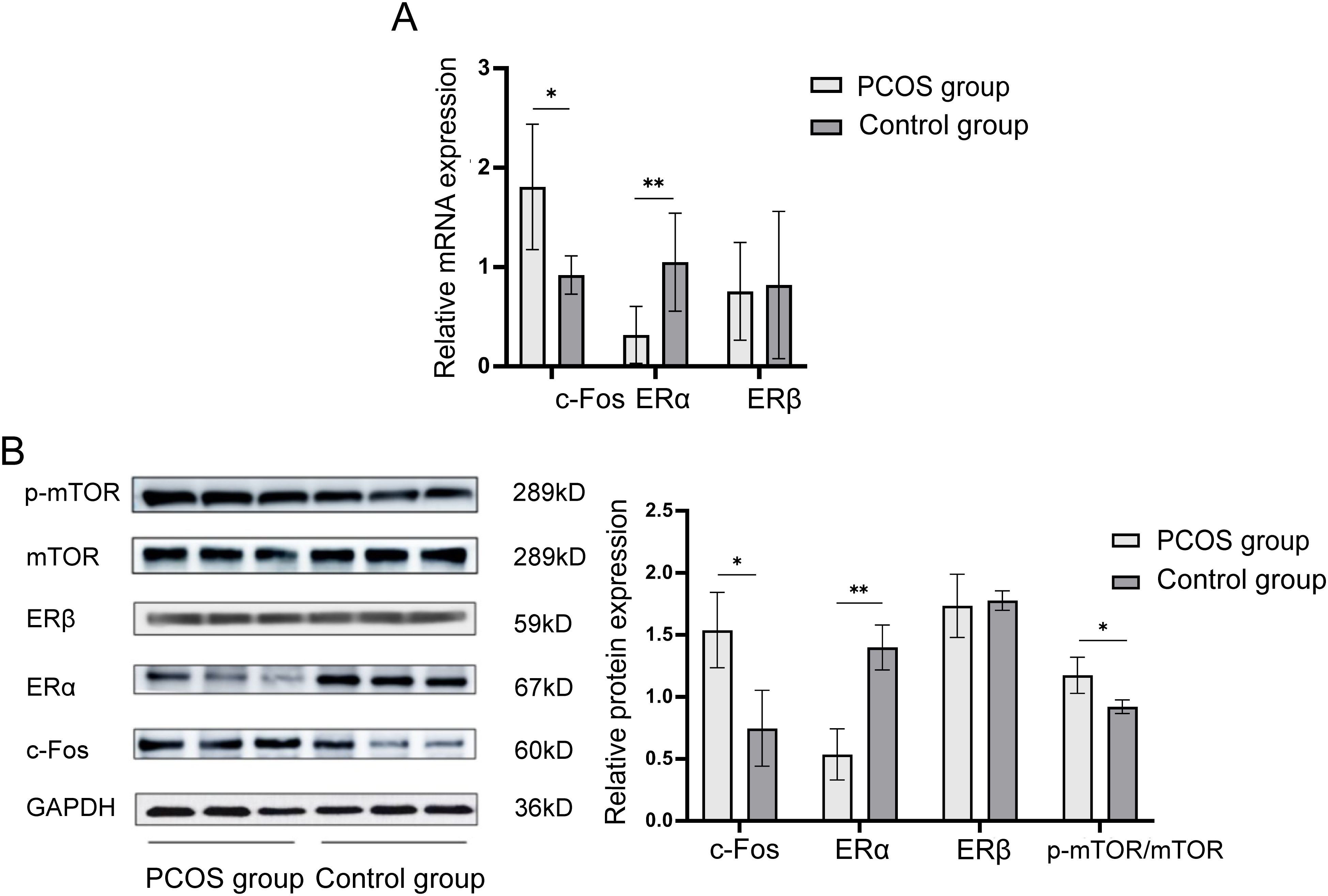 Graphical representations of mRNA and protein expression in PCOS versus control groups. Panel A shows a bar chart of relative mRNA expression for c-Fos, ERα, and ERβ, with significant differences indicated. Panel B displays protein expression with Western blot images and a bar chart showing relative protein expression levels for p-mTOR, mTOR, ERβ, ERα, c-Fos, and GAPDH, highlighting significant differences in c-Fos, ERα, and p-mTOR/mTOR between groups.