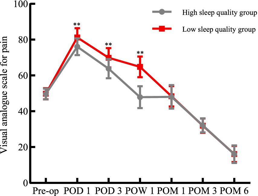 Line graph showing the visual analogue scale for pain over time, comparing high and low sleep quality groups. The low sleep quality group consistently reports higher pain levels. Both groups start at similar levels pre-operation, peak at postoperative day one, and gradually decline through postoperative month six. Error bars indicate variability, with significant differences marked at several points.