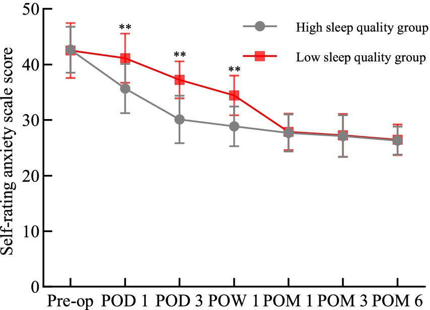 Line graph showing self-rating anxiety scale scores over time for high versus low sleep quality groups. The x-axis represents time periods: Pre-op, POD 1, POD 3, POW 1, POM 1, POM 3, POM 6. The y-axis shows scores ranging from 30 to 50. The low sleep quality group (red squares) has consistently higher scores than the high sleep quality group (gray circles), with significant differences marked by asterisks at Pre-op, POD 1, and POD 3. Both groups show a general decline in anxiety scores over time.