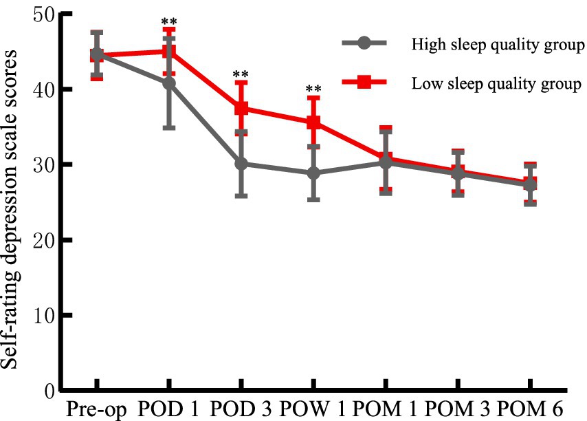 Line graph showing self-rating depression scale scores over time for high and low sleep quality groups. The x-axis includes time points: pre-operation, post-operative days one and three, post-operative weeks one, and post-operative months one, three, and six. The y-axis ranges from 20 to 50. Both groups start near 40, with scores decreasing over time. The low sleep quality group shows consistently higher scores than the high sleep quality group. Asterisks indicate significant differences at multiple points.
