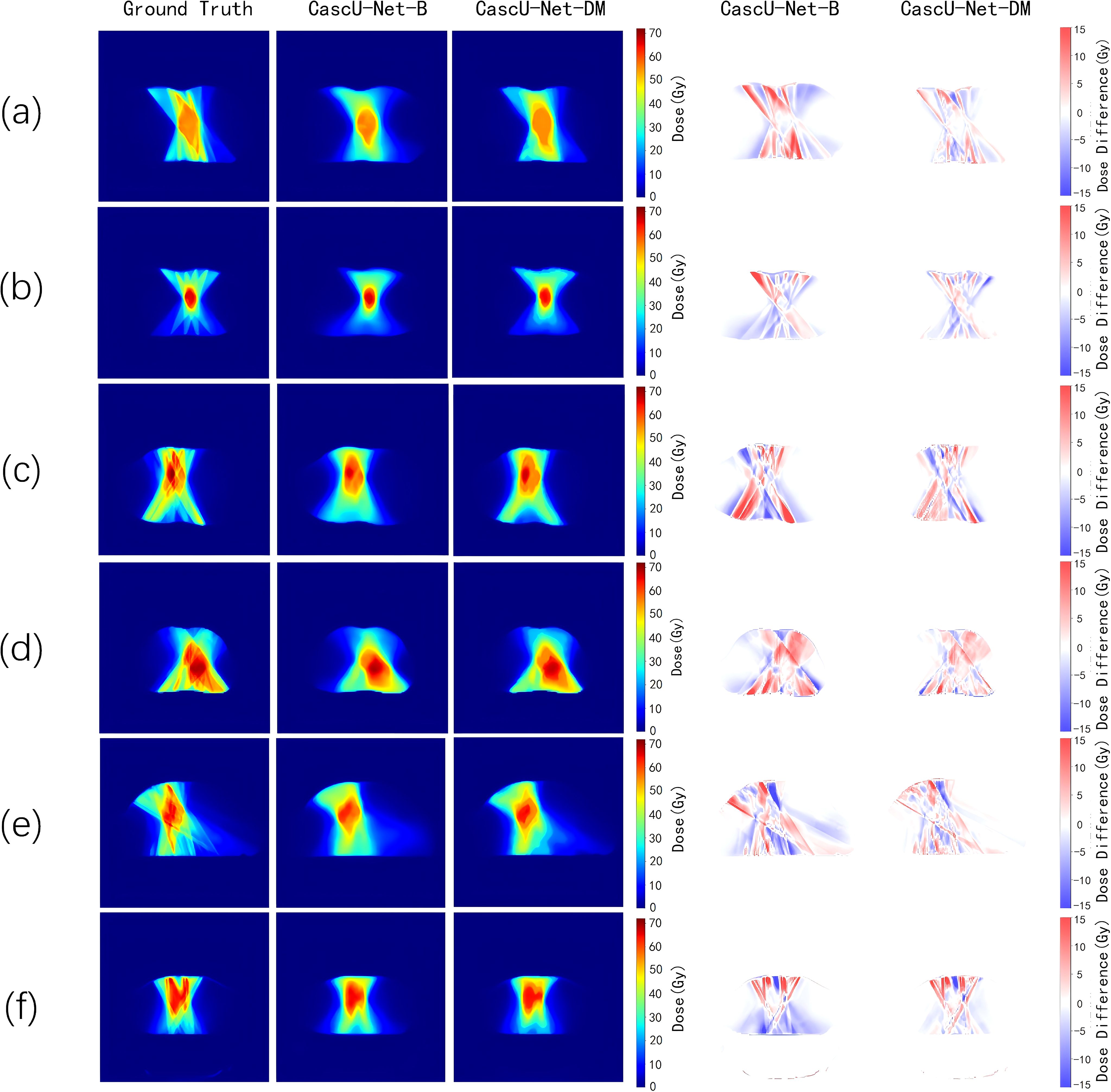 A series of medical imaging heatmaps presented in two columns and six rows. The first column shows dose distributions for Ground Truth, CascU-Net-B, and CascU-Net-DM. Dose levels are color-coded from blue (low) to red (high). The second column displays difference maps for CascU-Net-B and CascU-Net-DM, with colors indicating intensity differences. Each row, labeled from (a) to (f), visualizes different cases. Color scales on the sides provide a reference for dose levels and differences.