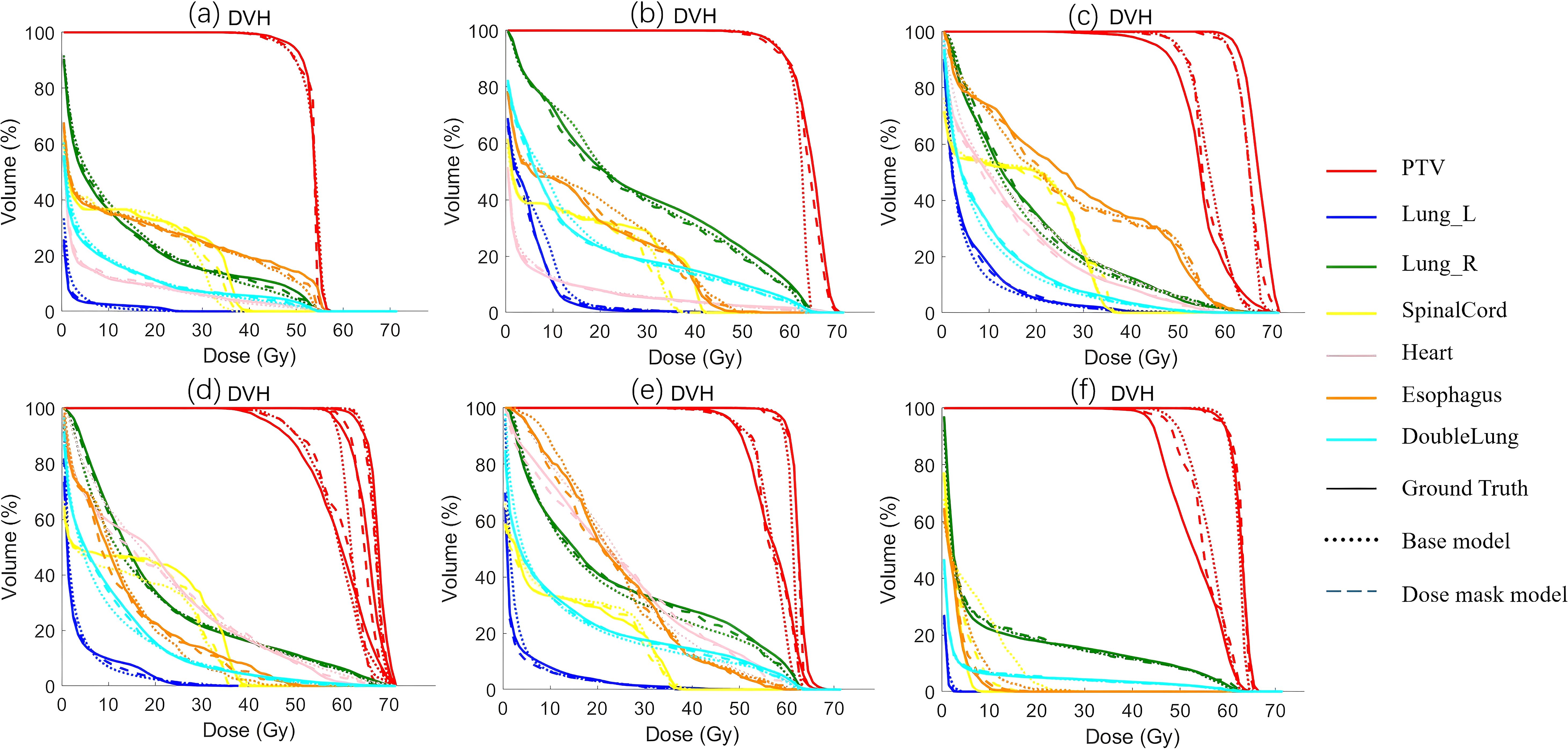 Dose-volume histograms (DVH) showing six panels (a to f), each representing different models or conditions. The graphs plot volume percentage against dose in gray (Gy). Curves represent various organs and tissues: PTV in red, Lung_L in blue, Lung_R in green, SpinalCord in yellow, Heart in pink, Esophagus in orange, DoubleLung in cyan, and both base and dose mask models compared to ground truth. A legend clarifies line styles for each model.
