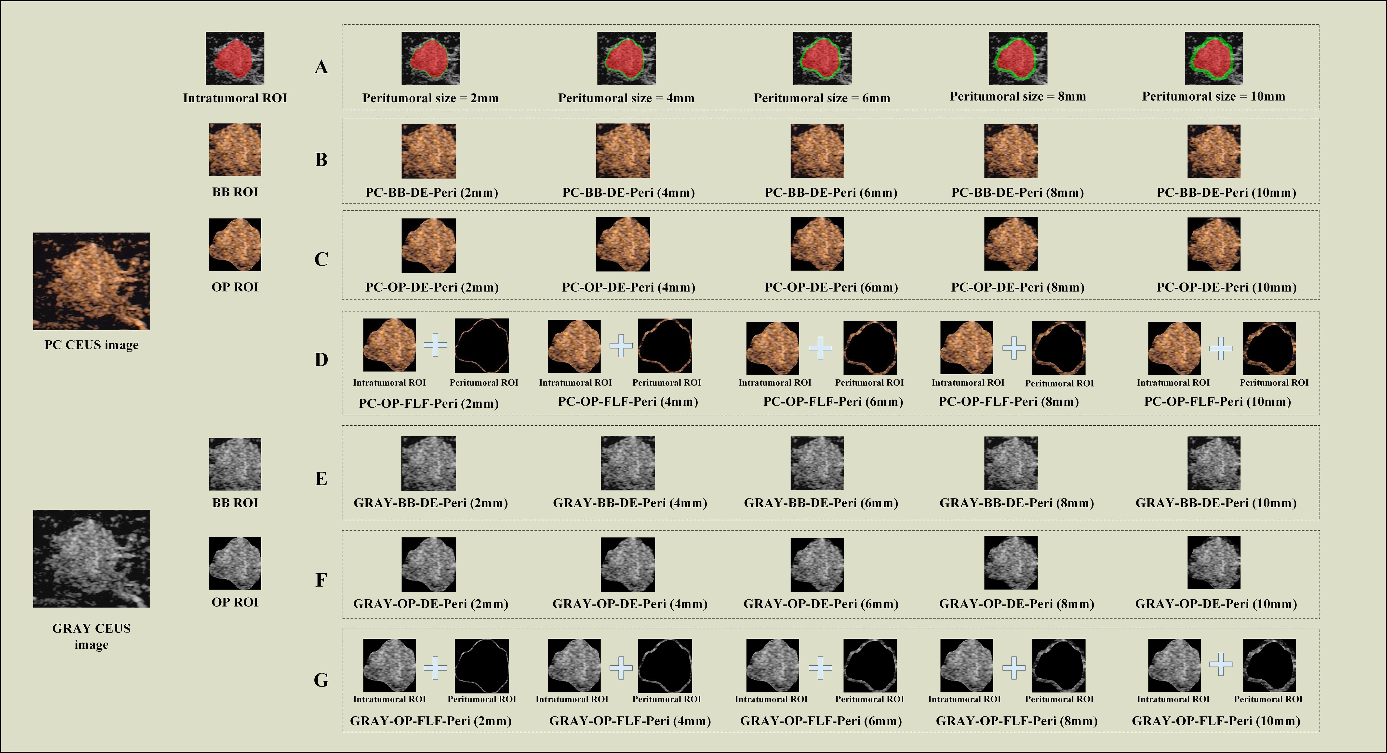 Medical imaging diagram showing various regions of interest (ROI) in color-coded ultrasound images. Rows A to G display different analysis methods like PC and GRAY CEUS with variations for intratumoral and peritumoral ROIs. Columns indicate peritumoral sizes from two millimeters to ten millimeters. Labels such as BB ROI and OP ROI describe specific regions analyzed.
