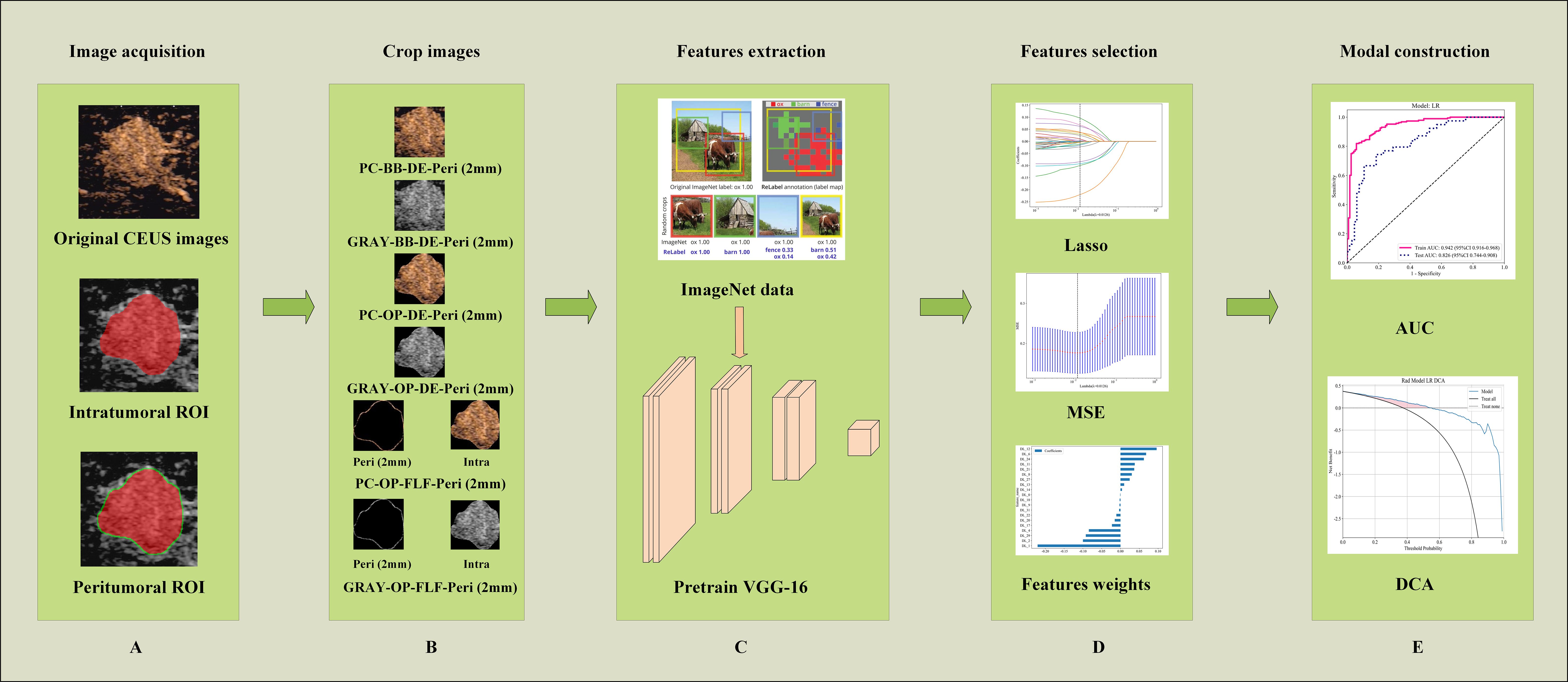 Flowchart illustrating a process with five stages. A: Image acquisition includes original CEUS images and regions of interest (ROI) for intratumoral and peritumoral areas. B: Cropped images in various formats are displayed. C: Features extraction uses ImageNet data with a pretrained VGG-16 model. D: Feature selection involves Lasso and Mean Squared Error (MSE) analysis with feature weights. E: Model construction includes Area Under the Curve (AUC) and Decision Curve Analysis (DCA) graphs.