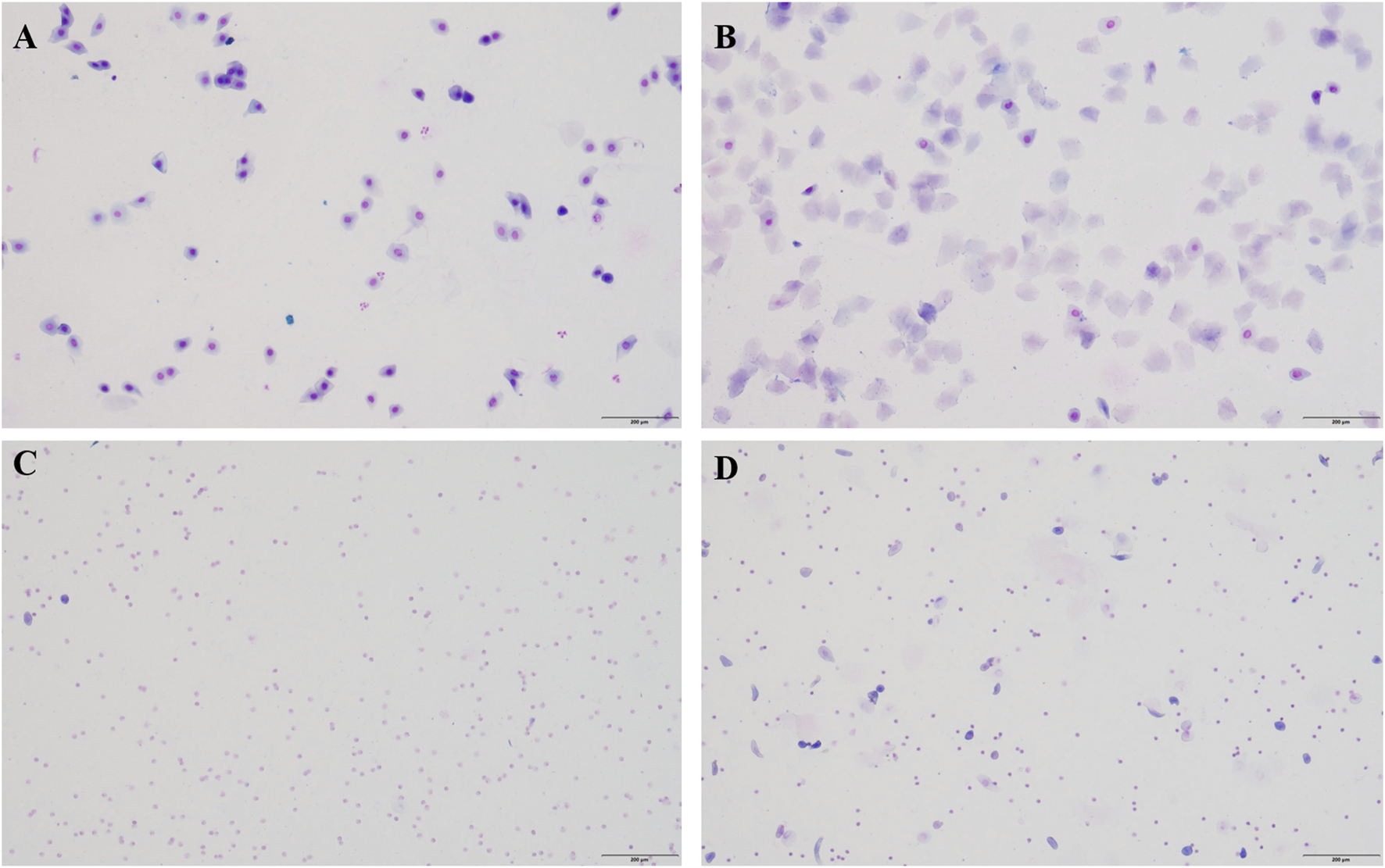 Microscopic images labeled A, B, C, and D show cellular samples with varying densities and arrangements. Image A and B have clusters of darker stained cells, while images C and D feature more widely dispersed and lighter stained cells. Scale bars indicate magnification.