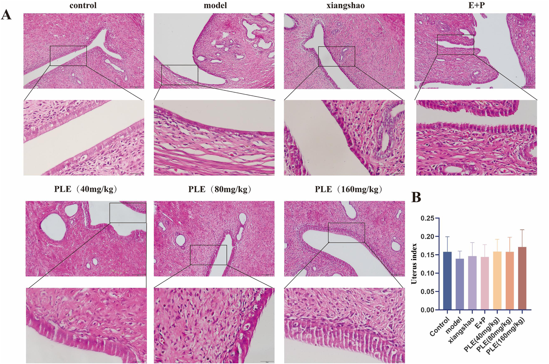 Image A shows a series of histological slides with magnified insets, comparing tissue samples under different conditions: control, model, xiangshao, E+P, and PLE at doses of 40 mg/kg, 80 mg/kg, and 160 mg/kg. Each slide displays tissue morphology. Image B is a bar chart illustrating the uterus index across these conditions, with similar values and slight variations among the groups.