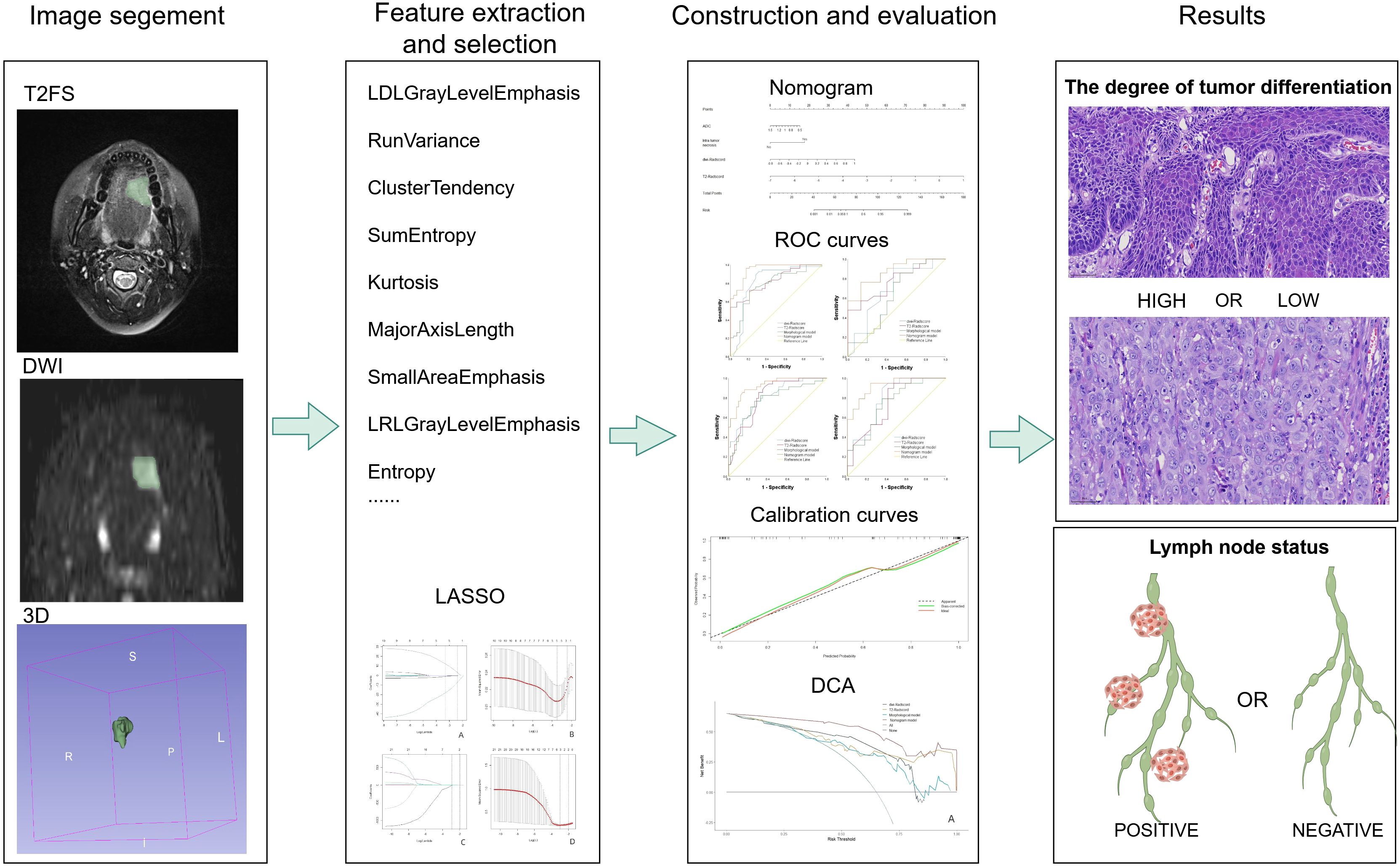 Flowchart illustrating the process of predicting tumor differentiation and lymph node status. It begins with image segmentation using T2FS, DWI, and 3D imaging. Next, features like Gray Level Emphasis and Entropy are extracted and selected, followed by LASSO analysis. Construction and evaluation involve nomograms, ROC, and calibration curves. Results show tumor differentiation (high or low) and lymph node status (positive or negative).