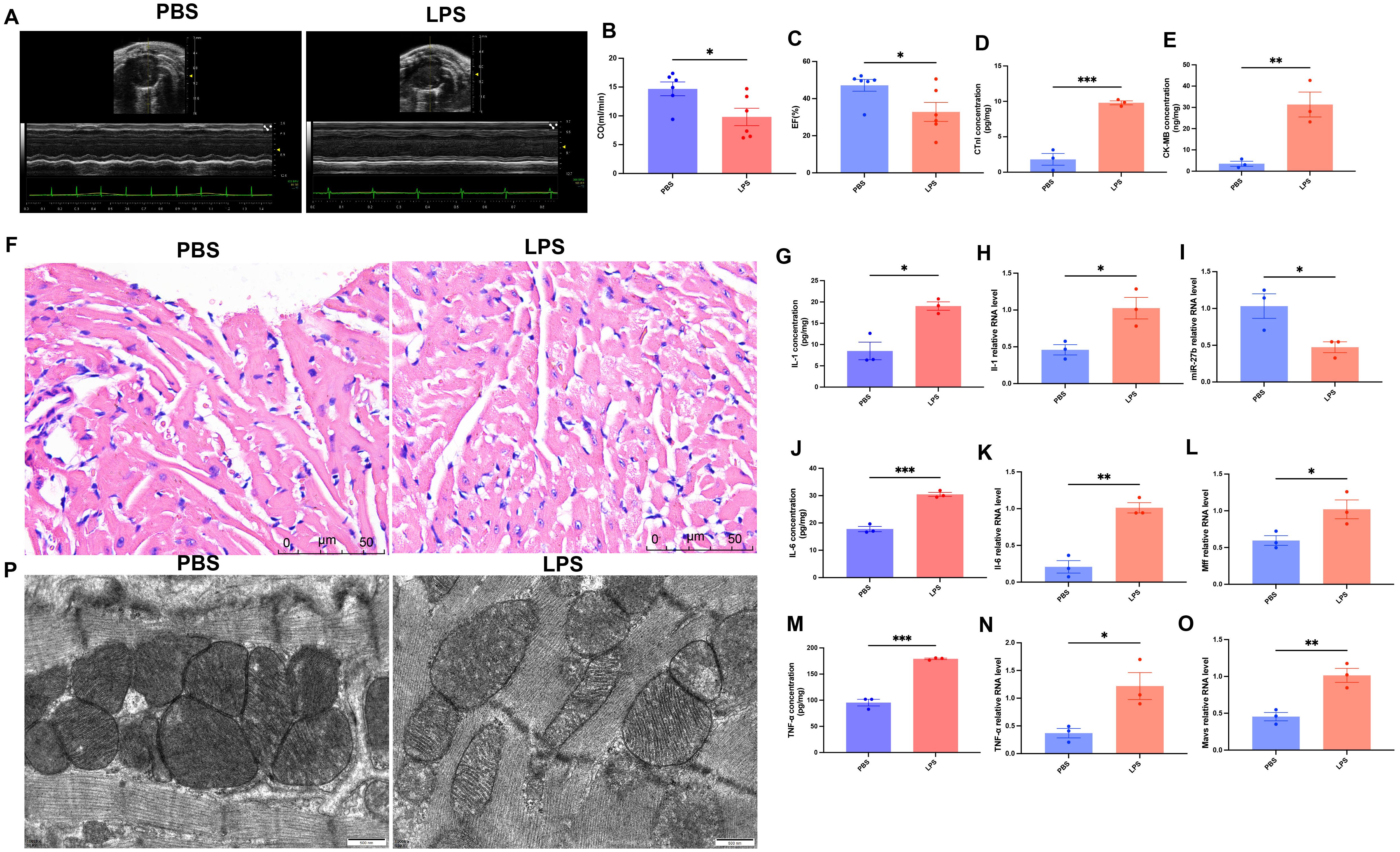 Images show the effects of PBS and LPS treatments on various parameters. Panel A displays ultrasound images. Panels B-O contain bar graphs comparing parameters like cytokine levels and RNA expressions. Panel F shows histological images with tissue stained. Panel P includes electron microscopy images highlighting ultrastructural differences. Bar graphs depict significant changes with asterisks indicating statistical significance between groups.