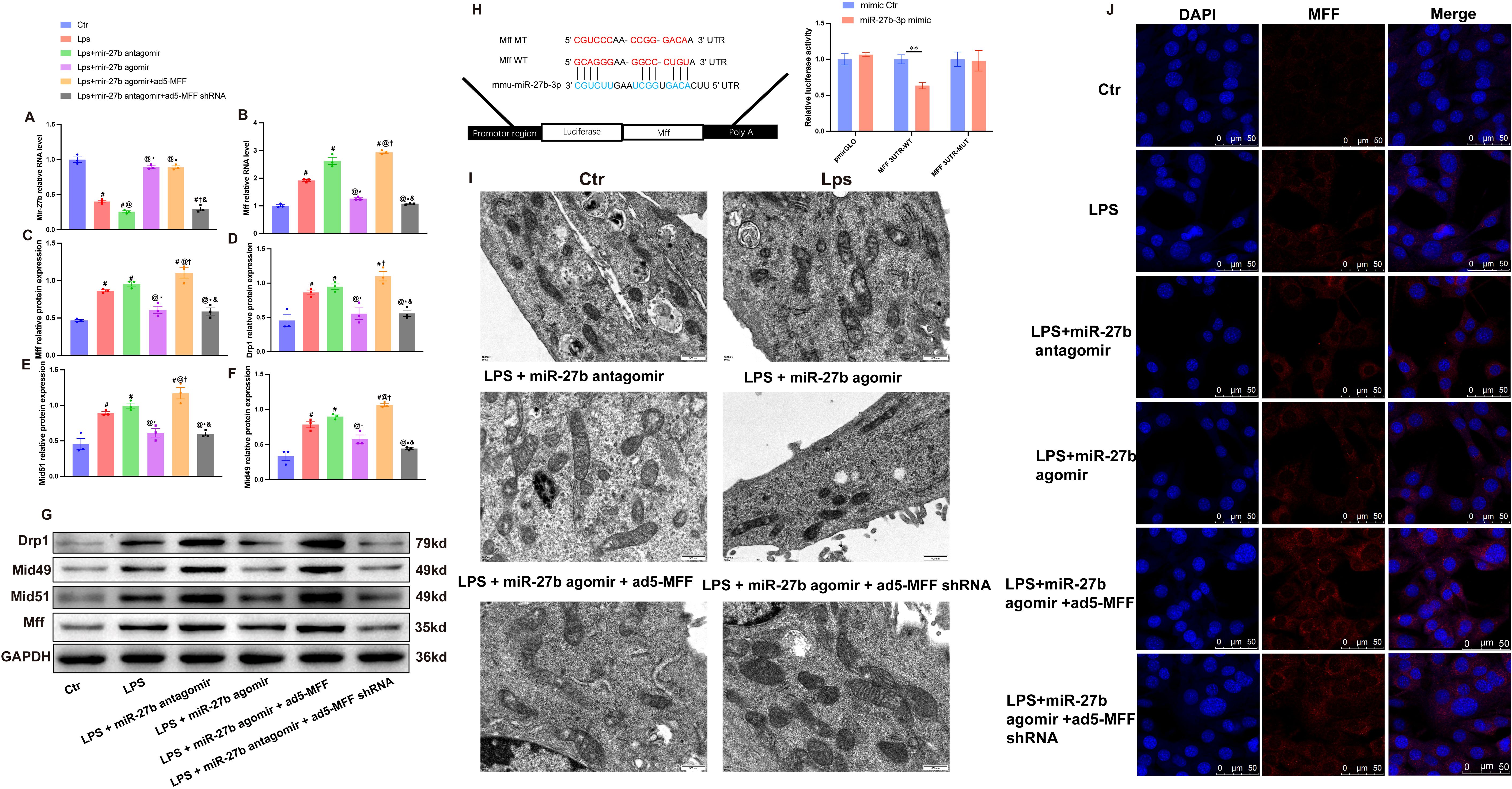 Scientific figures show various experimental results. Panels A-F include bar graphs comparing miR-27b, Mff mRNA, and protein expressions under different conditions, color-coded by treatments. Panel G displays Western blot results for proteins Drp1, Mid49, Mid51, Mff, and GAPDH across the same conditions. Panel H presents a schematic of miR-27b targeting Mff mRNA sequences with an accompanying bar graph showing luciferase activity. Panel I shows electron microscopy images of cells under various treatments. Panel J displays immunofluorescence images with DAPI and MFF staining, indicating localization under different conditions.