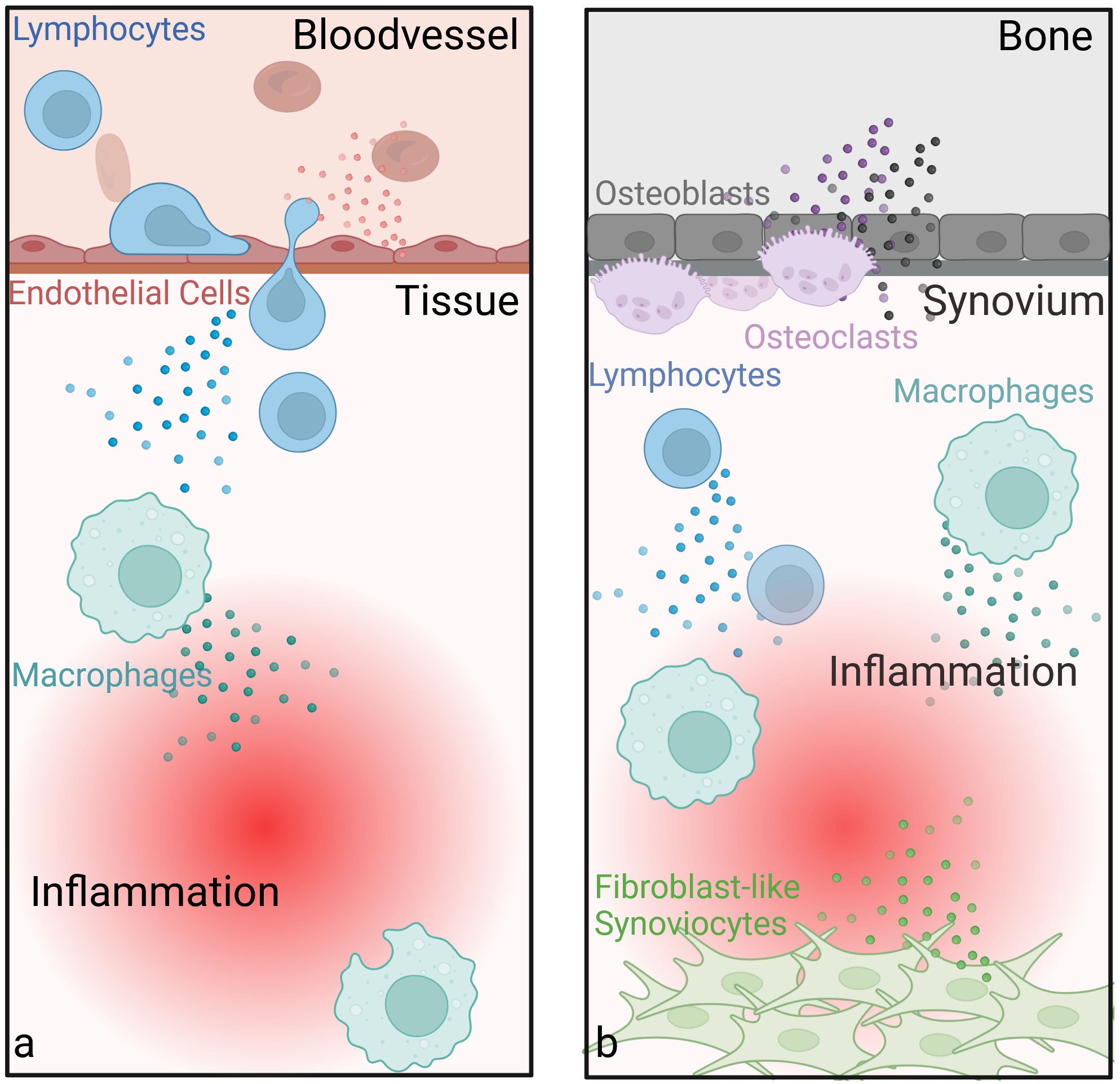 Two-part illustration depicting inflammatory responses. Panel A shows lymphocytes and macrophages moving from a blood vessel into tissue, with a red zone indicating inflammation. Panel B shows a bone with osteoblasts and osteoclasts above a synovium layer containing lymphocytes, macrophages, and fibroblast-like synoviocytes, also indicating inflammation with a red zone.