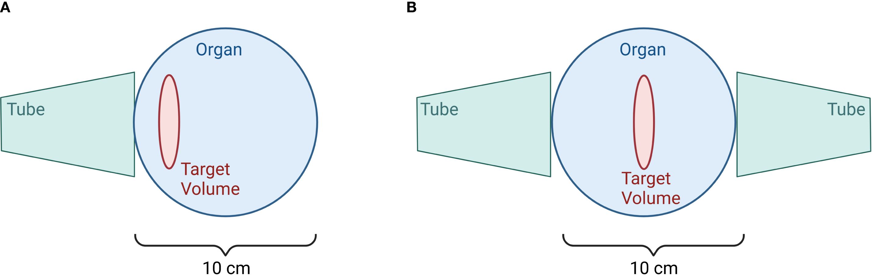 Diagram illustrating two scenarios (labeled A and B) comparing the position of tubes around an organ with a target volume highlighted in red. Both scenarios show a circular organ with a target volume inside, each flanked by triangular tubes. The setup spans 10 centimeters in width.