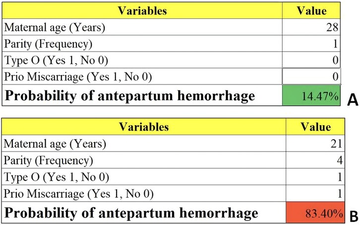 Table A shows variables and values for maternal characteristics, including age twenty-eight, parity one, Type O zero, and prior miscarriage zero, with a 14.47% probability of antepartum hemorrhage. Table B shows maternal age twenty-one, parity four, Type O one, and prior miscarriage one, with an 83.40% probability.