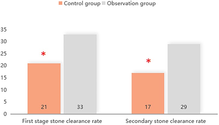 Bar chart comparing stone clearance rates between control and observation groups. The first stage: control group 21, observation group 33. Secondary stage: control group 17, observation group 29. Observation group bars are higher in both stages.