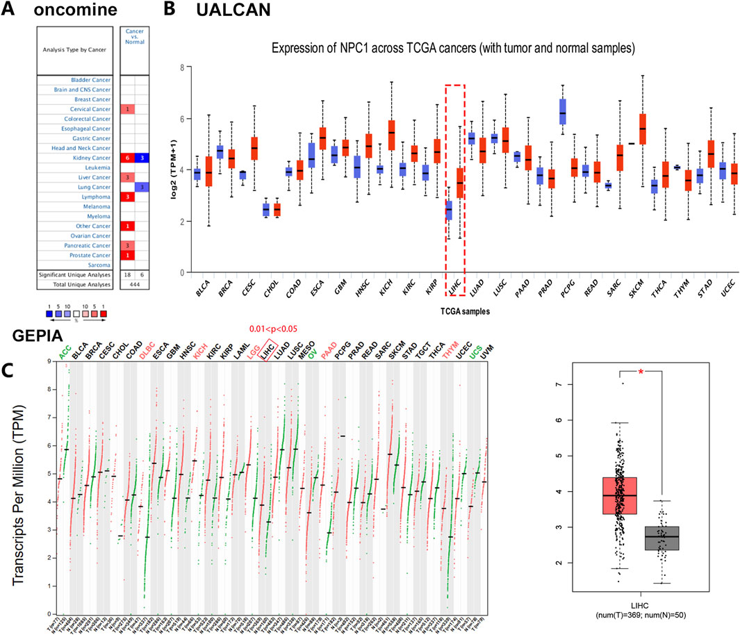 Three-part image showing cancer analysis data. Panel A: Oncomine analysis type by cancer, with a blue and red color scale indicating the number of analyses. Panel B: UALCAN box plots showing NPC1 expression across various TCGA cancers, comparing tumor and normal samples. Panel C: GEPIA scatter plot showing transcripts per million for different cancers, highlighting significance with p-value thresholds, alongside a box plot comparing tumor and normal samples for liver hepatocellular carcinoma (LIHC).
