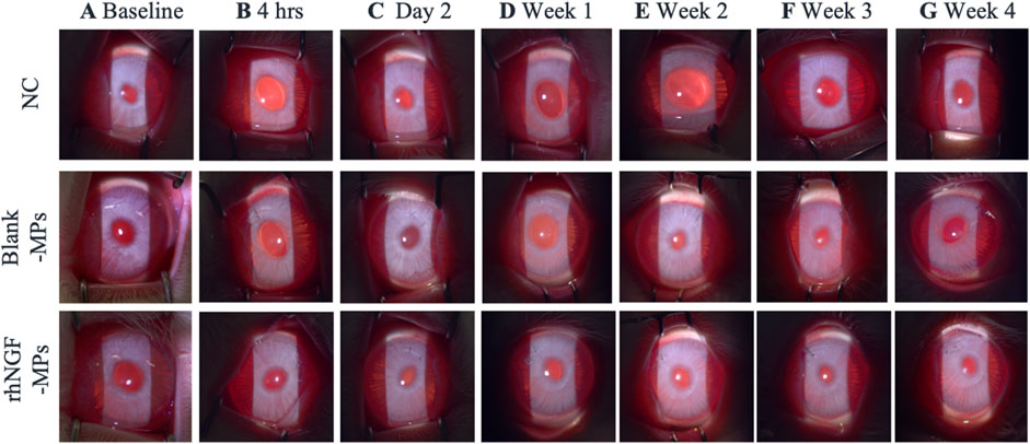 Series of images showing three rows of eyes at different time points during treatment. The top row (NC), middle row (Blank-MPs), and bottom row (rhNGF-MPs) are labeled. Columns represent time: Baseline, 4 hours, Day 2, Week 1, Week 2, Week 3, and Week 4, displaying changes in eye appearance over time.