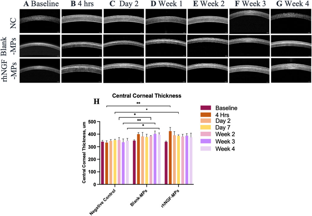 Sequential optical images of corneal tissue from baseline to week four show variations across three treatment groups: NC, Blank-MPs, and rhNGF-MPs. Image H displays a bar graph of central corneal thickness over time for these groups, with measurements in micrometers. Significant differences are indicated by asterisks. Color-coded bars represent different time points: baseline, 4 hours, day 2, week 1, week 2, week 3, and week 4.