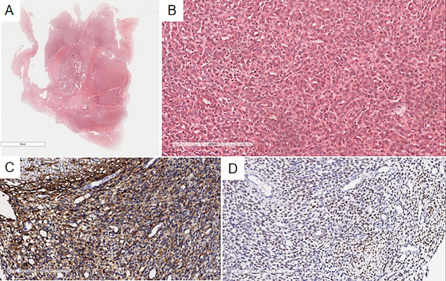 A set of four micrographs showing different tissue samples. A: A section of tissue with a semi-transparent pink appearance. B: A close-up of cell structures with dense pink staining. C: Brown-stained cells indicating immunohistochemical labeling, with a darker, textured pattern. D: Lightly stained cells with a sparse brown pattern, indicating a different level of labeling.