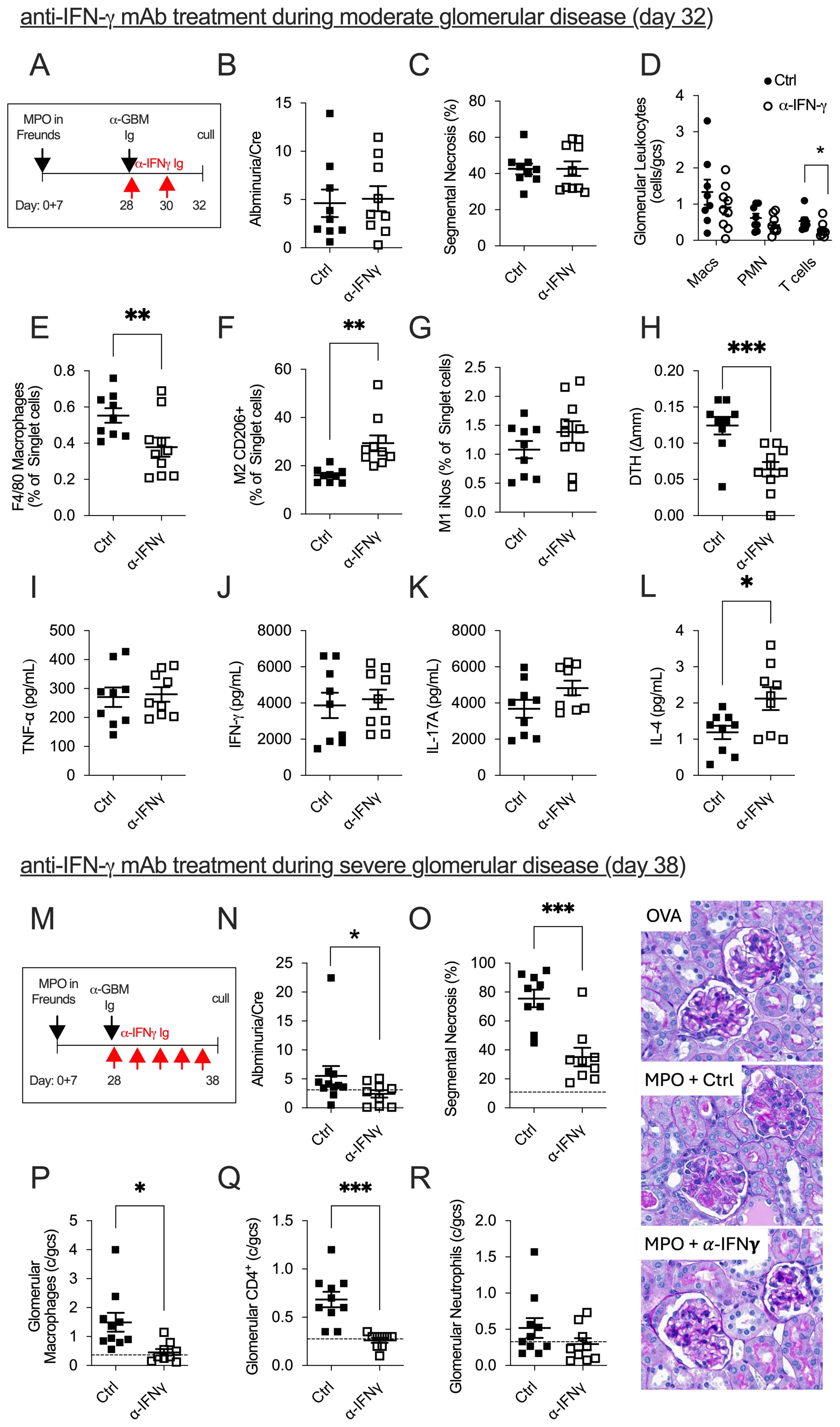 Diagram displays experimental results on anti-IFN-γ monoclonal antibody treatment in glomerular disease models. Panels A and M show treatment timelines. Graphs B-R compare control (Ctrl) and α-IFN-γ groups, displaying measures like albuminuria, segmental necrosis, cell populations, and cytokine levels. Asterisks indicate significance levels. Images on the right (OVA, MPO + Ctrl, MPO + α-IFN-γ) display kidney histology.