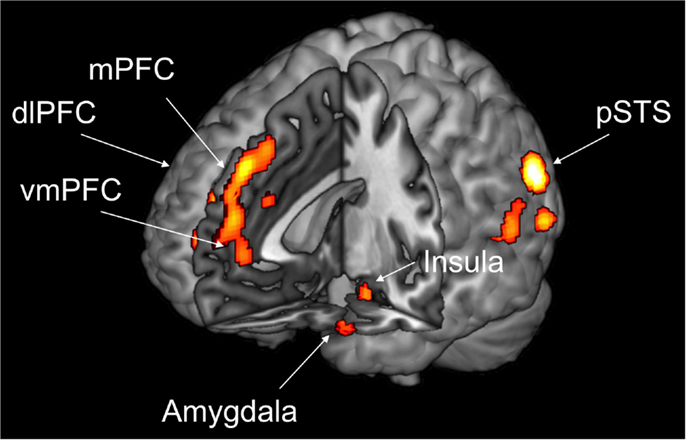 Figure 1 - Morality requires an interaction among several separate but connected brain regions, in particular the posterior superior temporal sulcus (pSTS), the insula, the amygdala, the medial prefrontal cortex (mPFC), the dorsolateral prefrontal cortex (dlPFC), and the ventromedial prefrontal cortex (vmPFC).