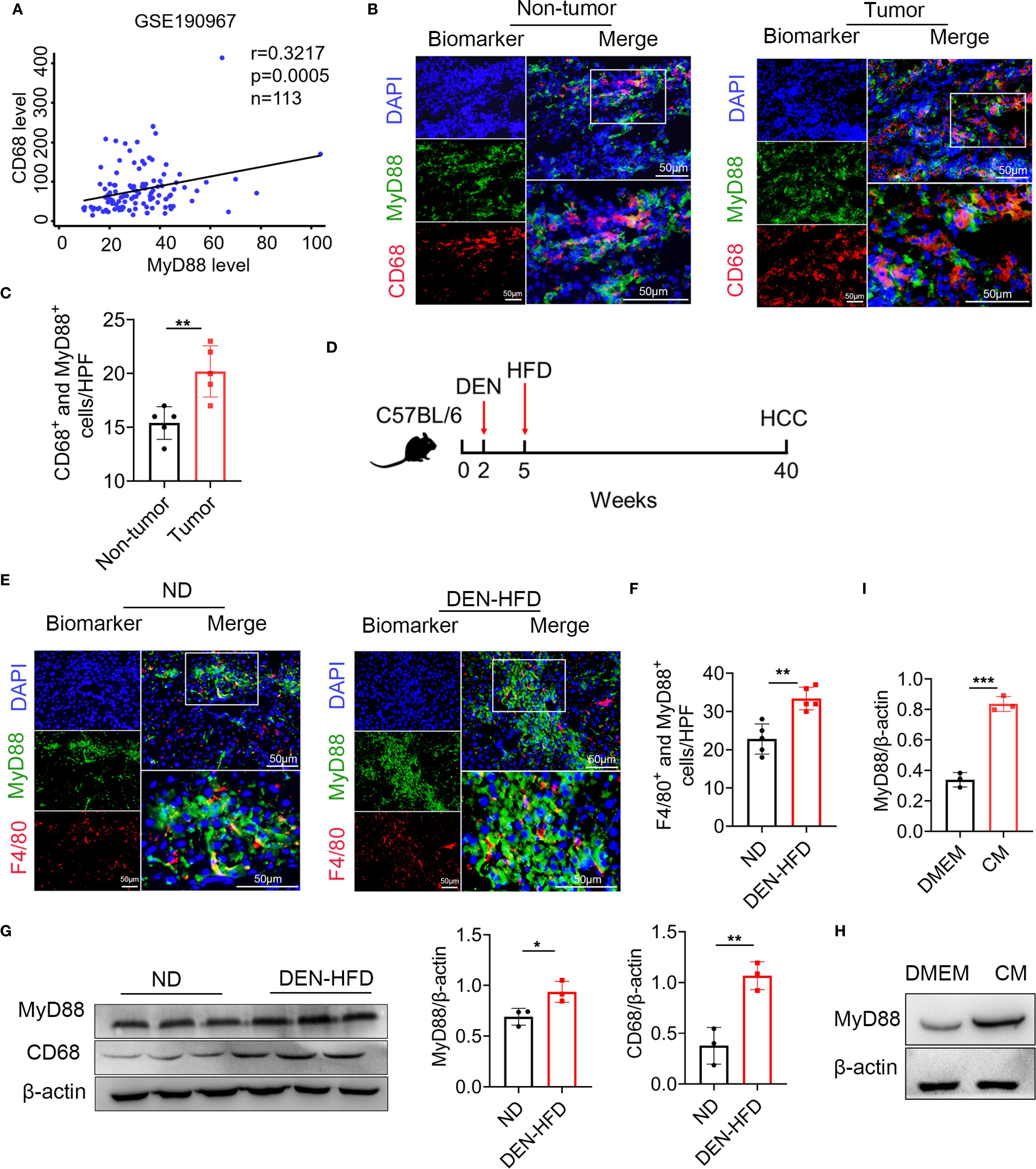 A multi-panel scientific figure illustrates various analyses of CD68 and MyD88 expressions in tumor and non-tumor tissues. Panel A displays a scatter plot with a positive correlation between MyD88 and CD68 levels. Panel B presents fluorescent staining of CD68 and MyD88 in non-tumor and tumor tissues. Panel C shows a bar graph indicating higher CD68⁺ and MyD88⁺ cell counts in tumor tissues. Panel D outlines a mouse study timeline. Panel E shows fluorescence imaging comparing ND and DEN-HFD groups. Panel F includes a bar graph of F4/80⁺ and MyD88⁺ cells. Panel G provides Western blot results for MyD88 and CD68 differences between ND and DEN-HFD, with bar graphs showing quantifications. Panel H shows Western blot data comparing DMEM and CM conditions. Panel I features a bar graph quantifying MyD88 expression in DMEM and CM.