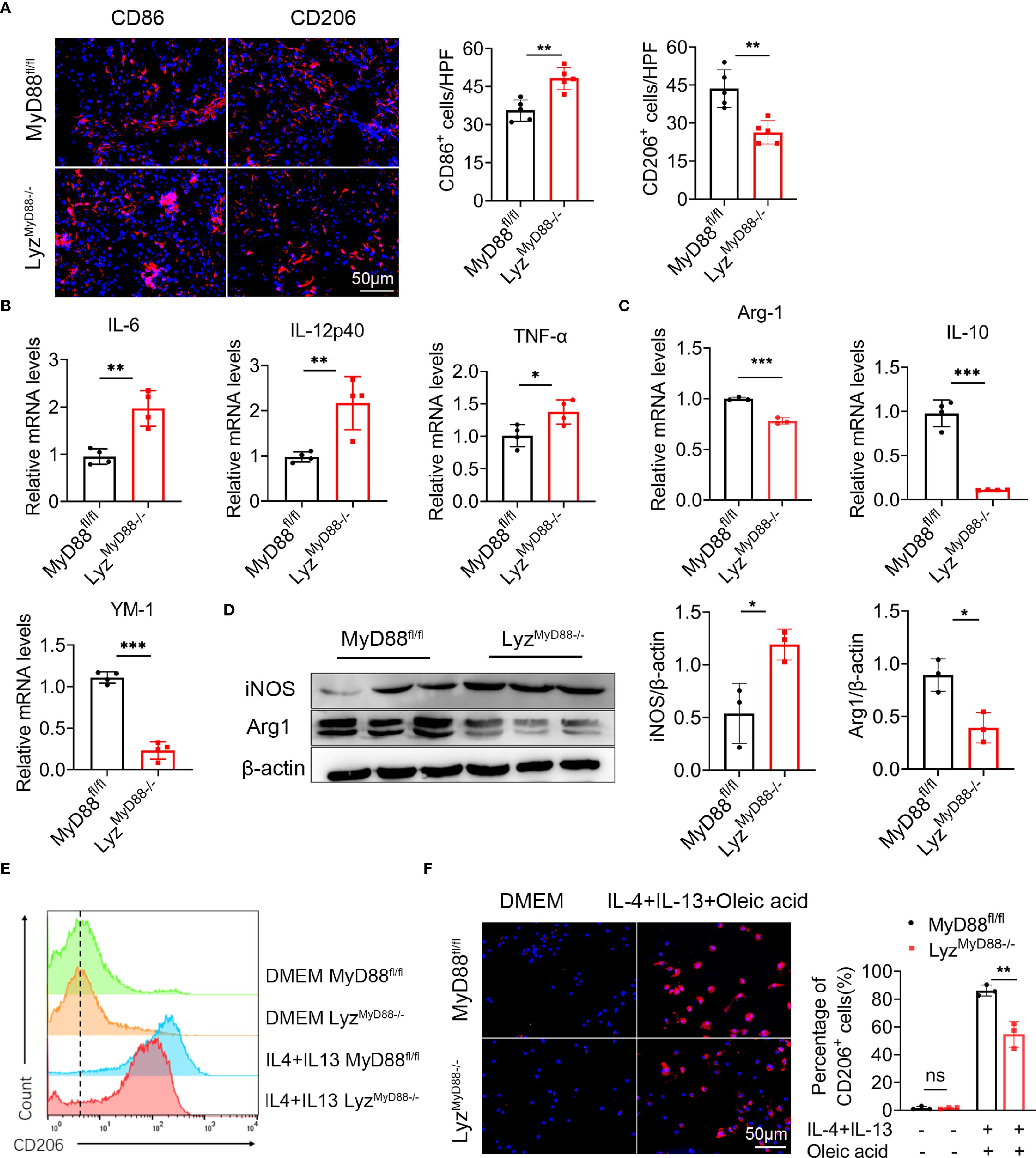 (A) Immunofluorescence showing CD86 and CD206 expression with quantification in MyD88fl/fl and LyzMyD88-/- mice. (B) Bar graphs displaying mRNA levels of IL-6, IL-12p40, TNF-α, and YM-1 in both genotypes. (C) Bar graphs indicating mRNA levels of Arg-1 and IL-10. (D) Western blot analysis for iNOS and Arg1 with densitometry analysis. (E) Flow cytometry histogram of CD206 expression under different conditions. (F) Immunofluorescence of CD206 with quantification under IL-4, IL-13, and oleic acid treatment, comparing MyD88fl/fl and LyzMyD88-/- cells. Scale bars indicate 50 micrometers.