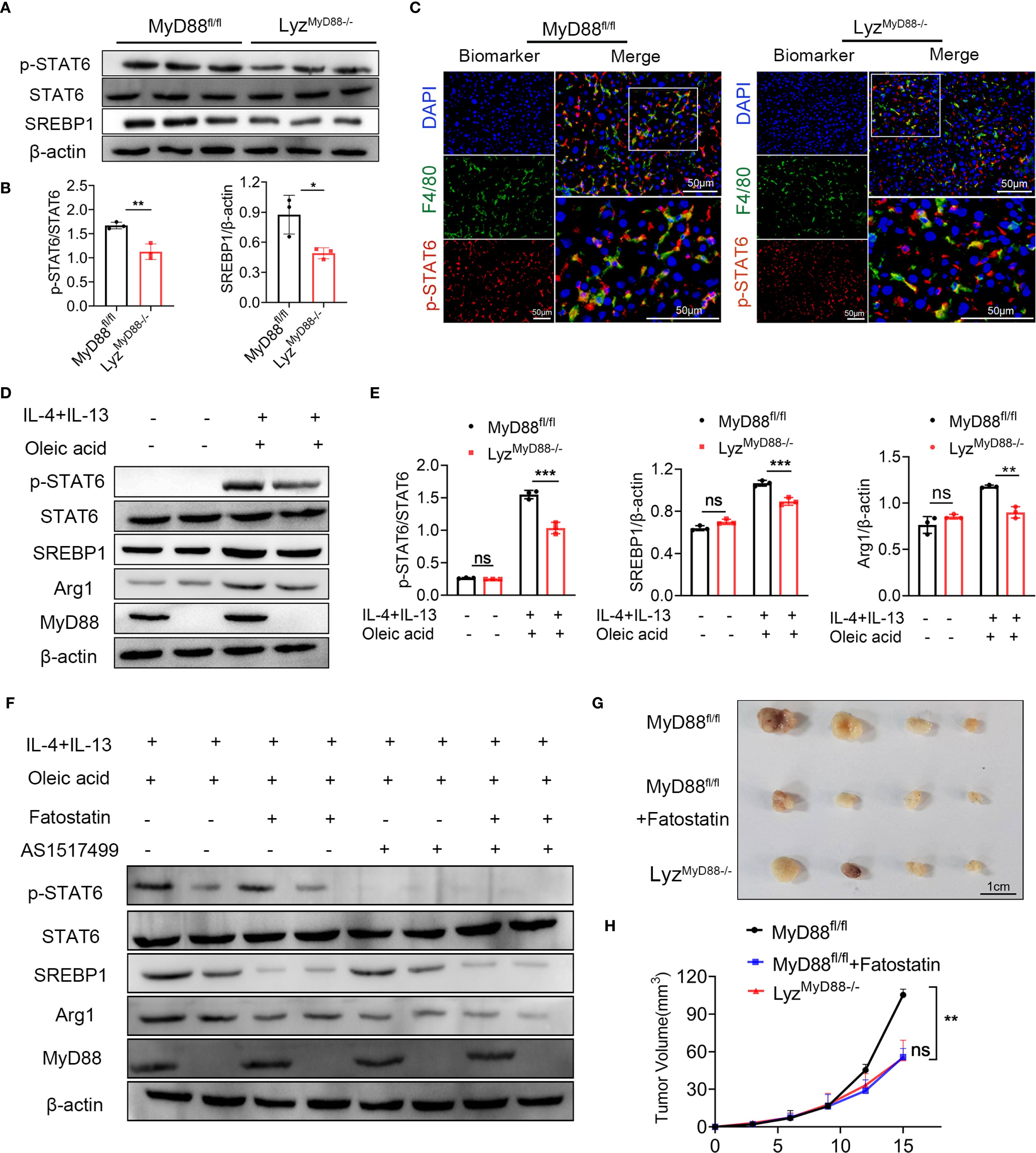 A multi-panel scientific figure depicts various experiments analyzing protein expression and tumor growth. Panel A shows Western blots comparing protein levels in MyD88 and Lyz MyD88-deficient mice. Panel B features bar graphs quantifying these protein levels. Panel C presents immunofluorescence images of tissue sections for biomarkers and merged images, with magnified insets. Panel D includes additional Western blots analyzing the effect of IL-4, IL-13, and oleic acid. Panel E displays bar graphs of protein expression under these conditions. Panel F shows blots exploring the impact of fatostatin and a specific inhibitor. Panel G depicts tumor samples from different groups. Panel H provides a line graph of tumor volume over time.