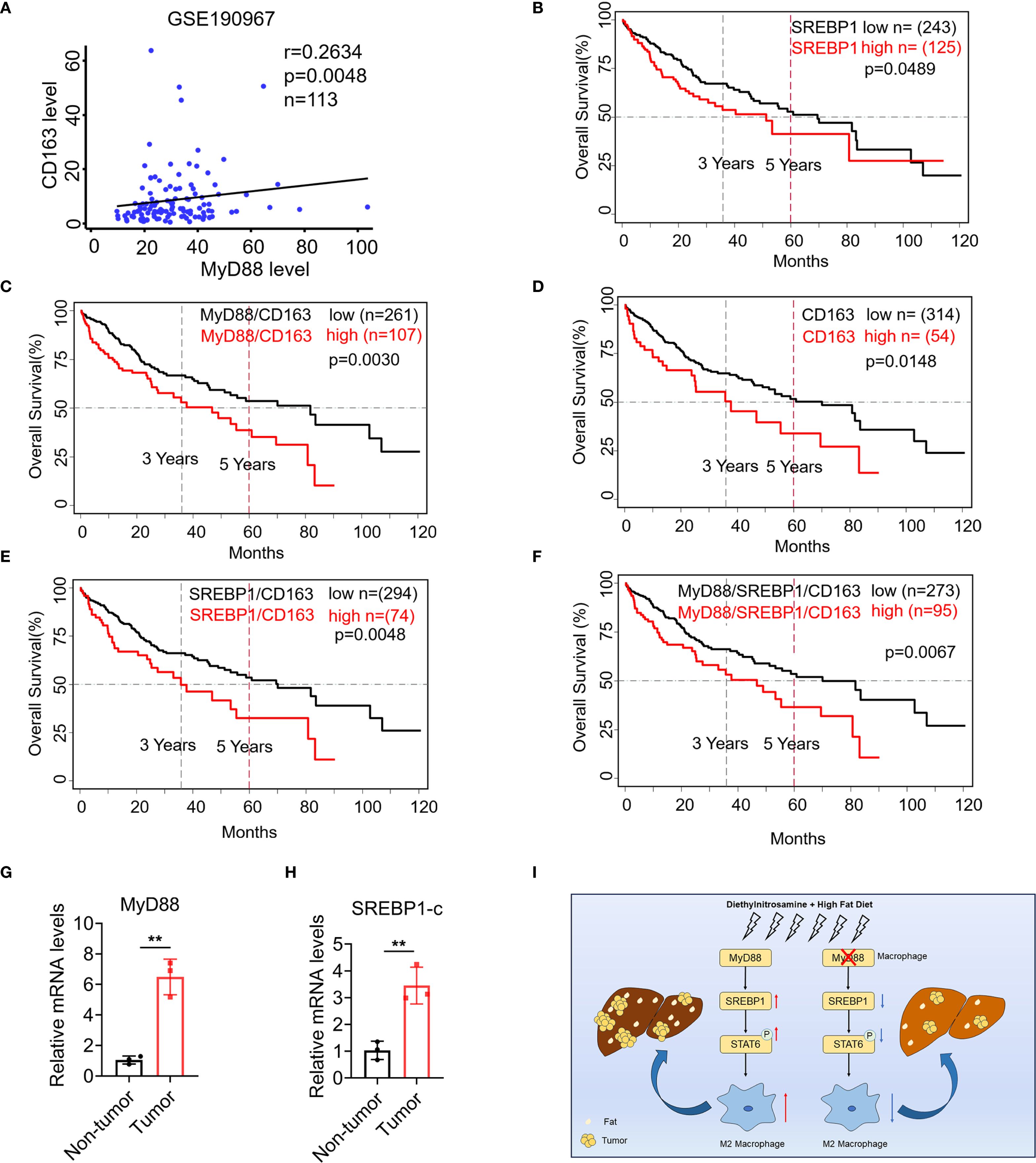 Scatter plot and survival analysis graphs depict the relationship between CD163, MyD88, SREBP1 levels, and overall survival across several datasets. The scatter plot shows a positive correlation between CD163 and MyD88 levels. Kaplan-Meier curves illustrate the influence of high or low expression levels on survival over time, with statistical significance indicated. Bar charts reveal significantly higher MyD88 and SREBP1-c mRNA levels in tumor versus non-tumor tissues. An illustration shows a mechanism involving MyD88, SREBP1, and macrophage differentiation in liver tissues affected by diet and exposure to diethylnitrosamine.