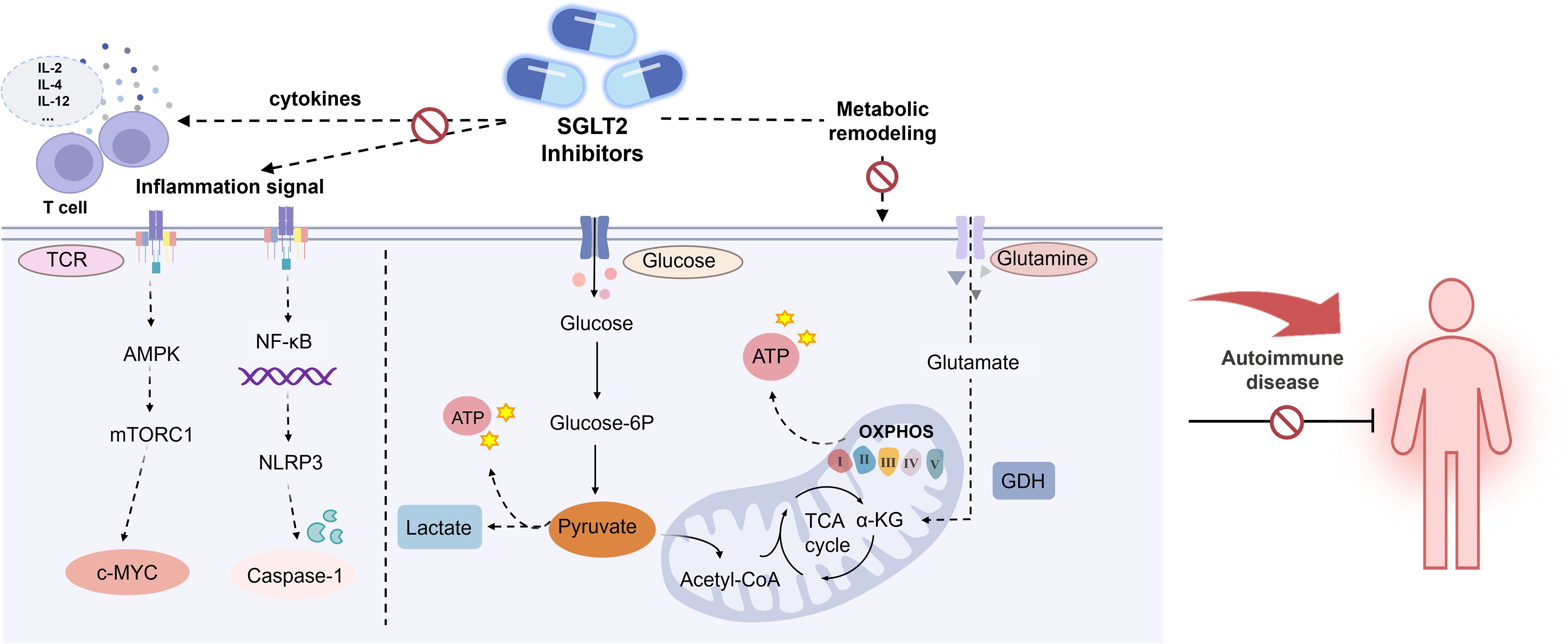 Illustration depicting a process where SGLT2 inhibitors disrupt cytokine production from T cells, inhibiting inflammation and metabolic remodeling, impacting autoimmune diseases. It shows glucose and glutamine pathways, ATP production, and downstream effects on autoimmune diseases.