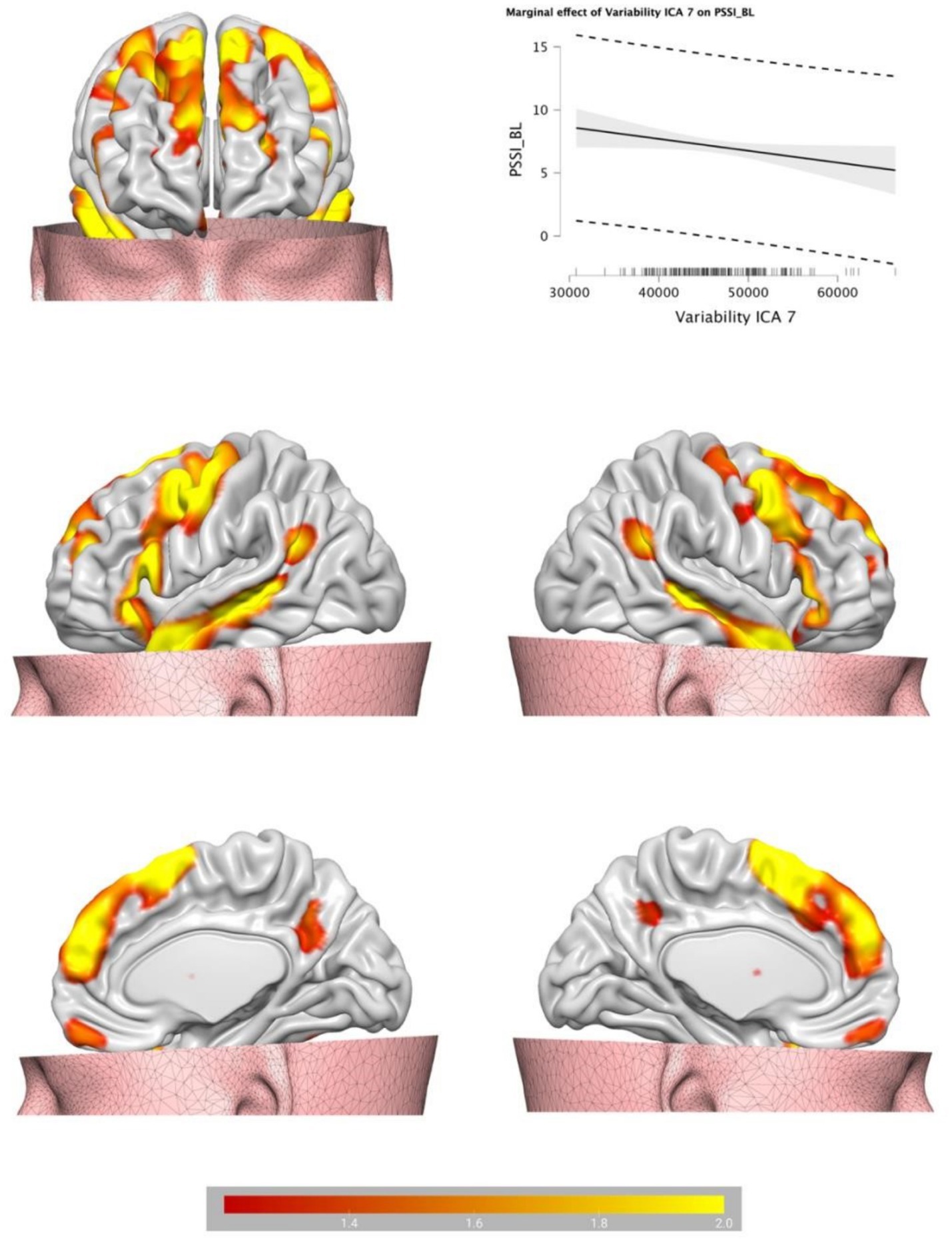 Brain scan images displaying highlighted regions in yellow and red, indicating areas of variable activity. A graph in the top right corner shows a marginal effect of variability on PSSI_BL with a downward trend. A color scale from red to yellow at the bottom represents different levels of intensity.