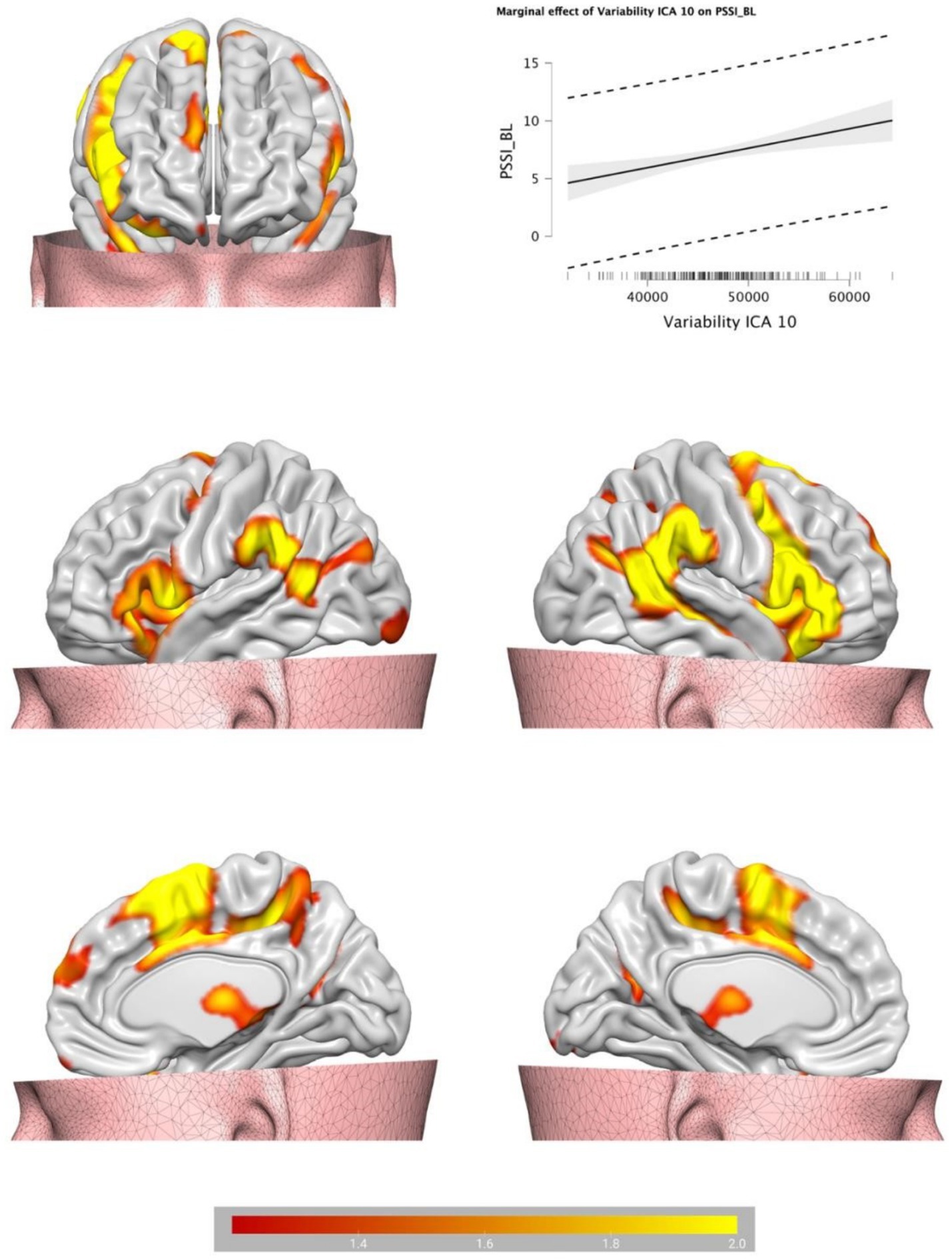 Four brain images with colored activity areas in yellow and red, highlighting different regions. A graph shows the marginal effect of variability ICA 10 on PSS1_BL, with a trend line and shaded confidence interval. A color scale at the bottom ranges from red to yellow, labeled 1.4 to 2.0.