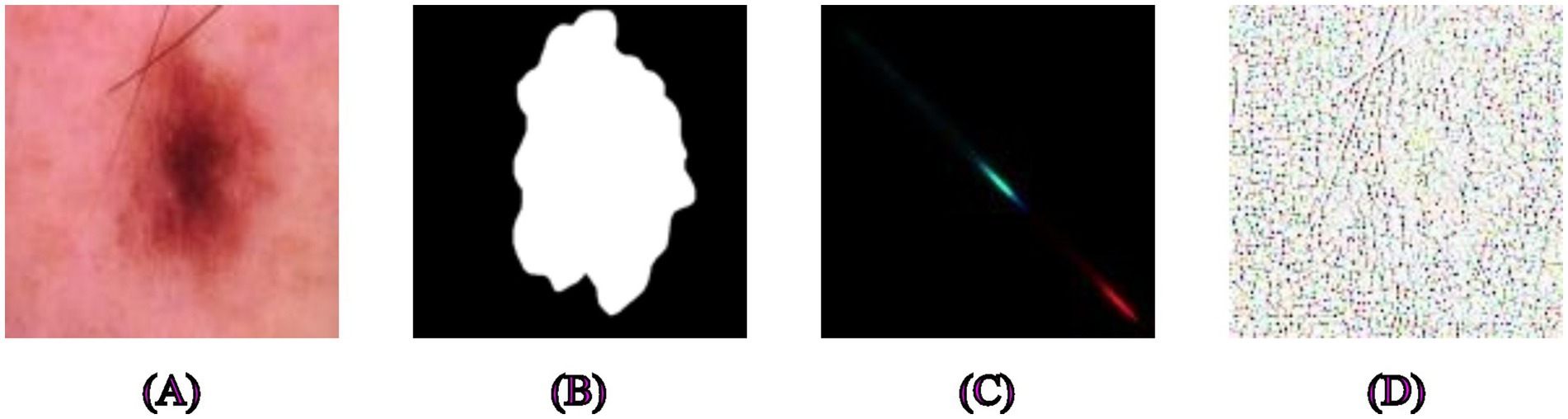 (A) Close-up image of a skin mole with irregular borders. (B) Binary image showing the outlined shape of the mole. (C) Spectrum line on a black background with colors transitioning from green to red. (D) Noisy image with scattered colored dots over a pale background.